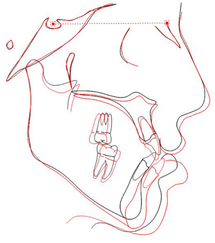 Symmetry 13 01150 g009