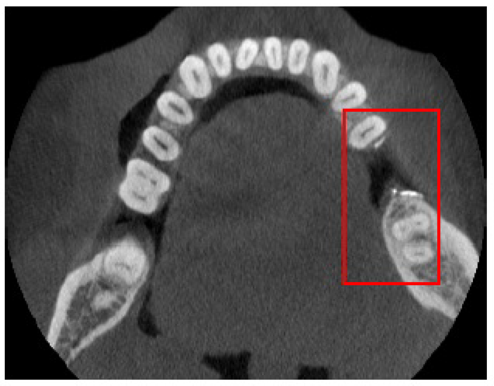 Symmetry 13 01450 g006