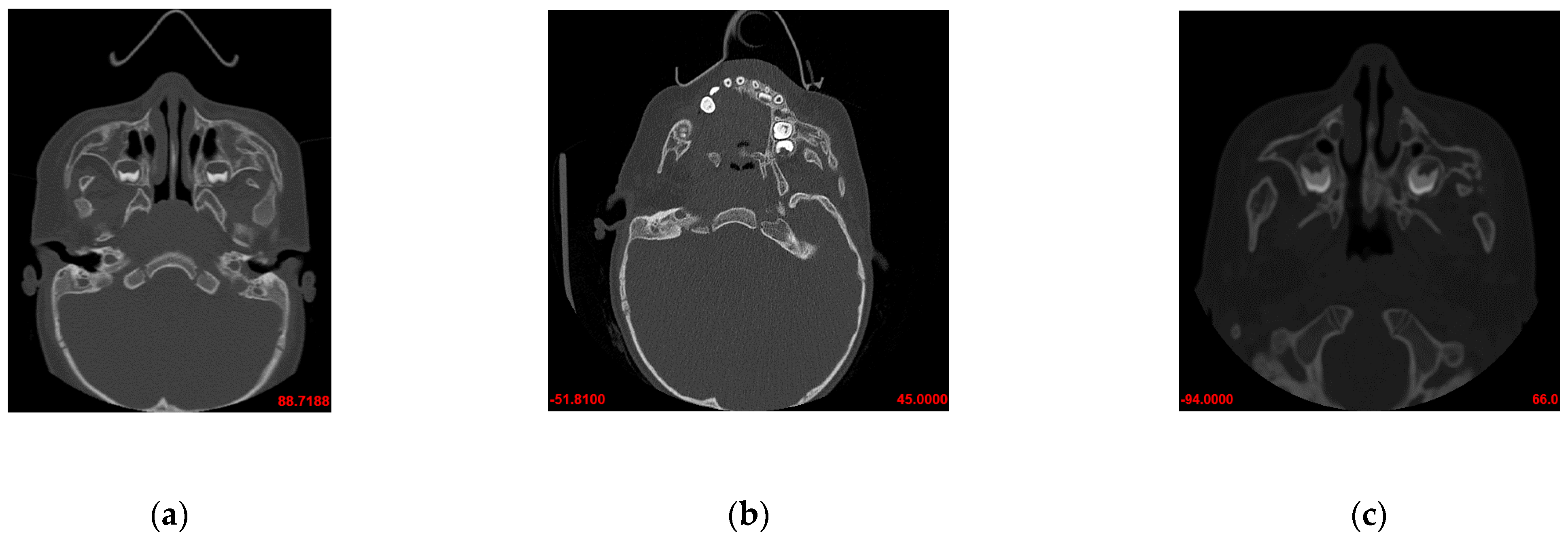 Symmetry 13 01634 g003