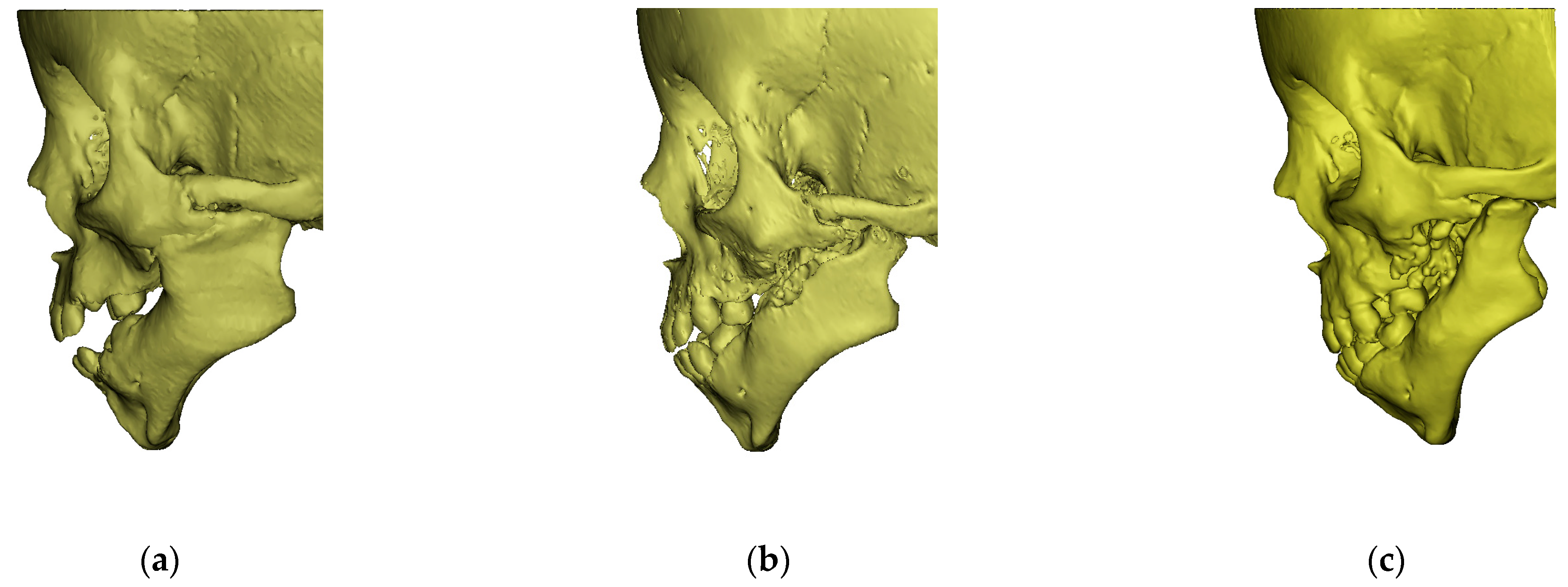 Symmetry 13 01634 g004