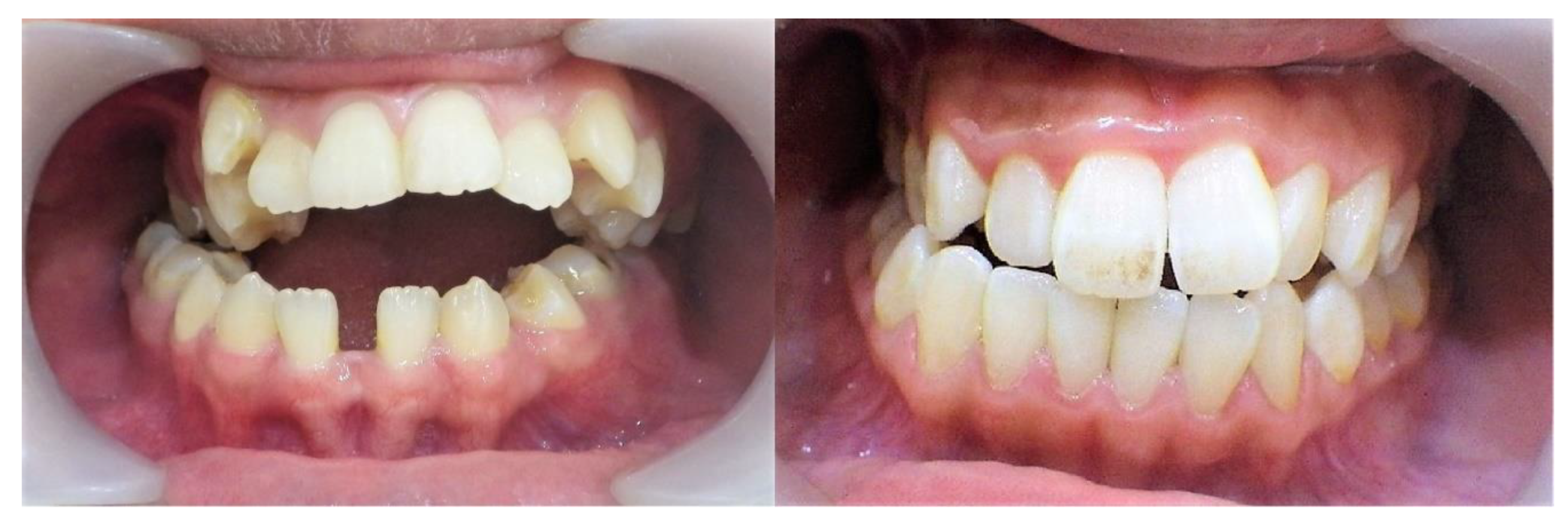 Symmetry 13 01661 g002