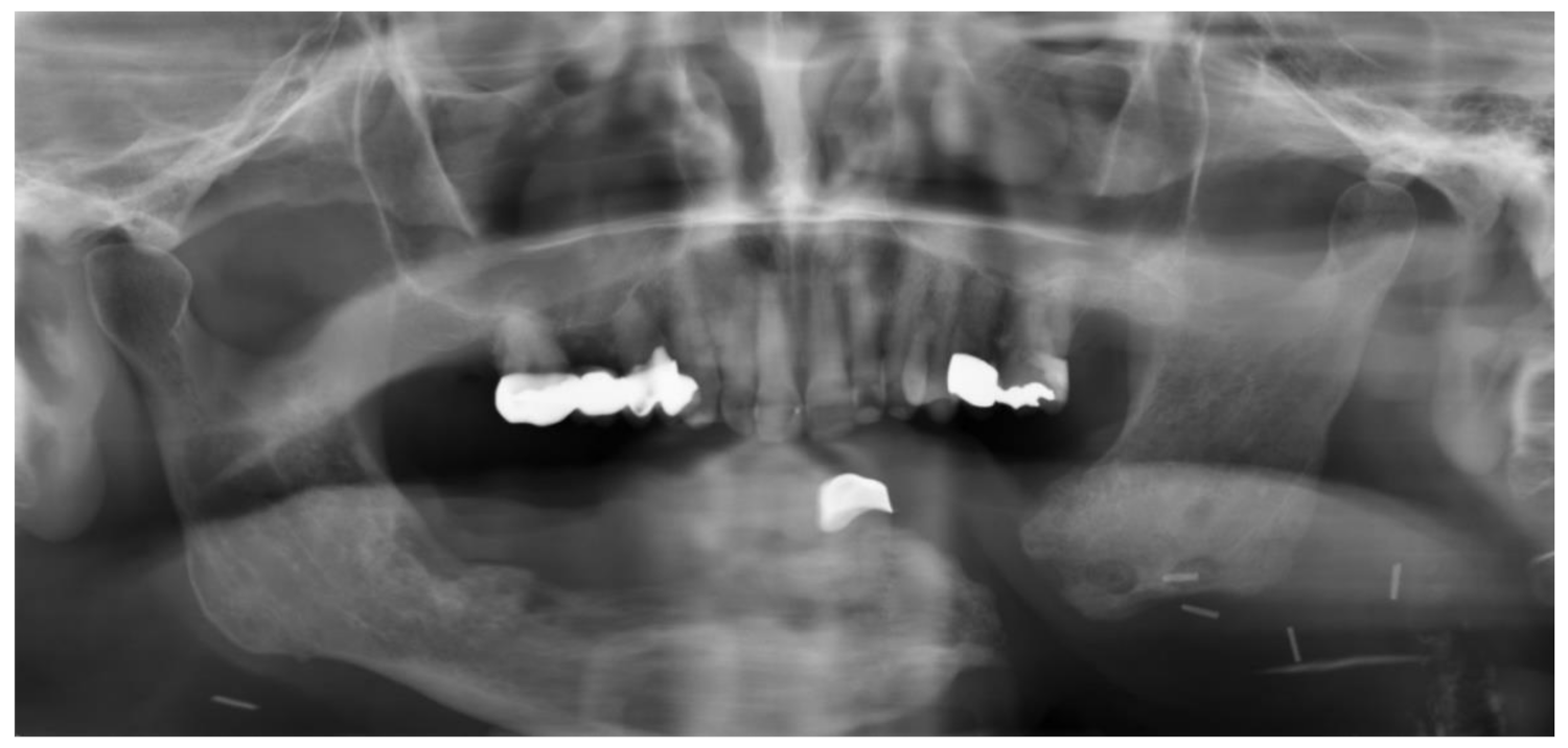 Symmetry 13 01741 g009