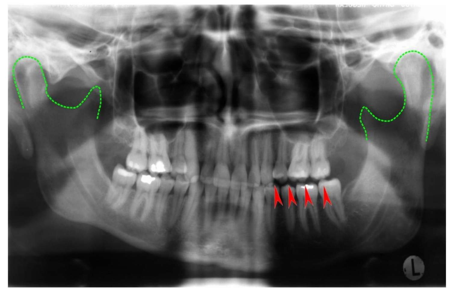 Symmetry 13 01741 g010