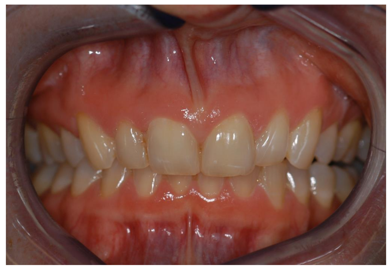 Symmetry 13 01741 g011