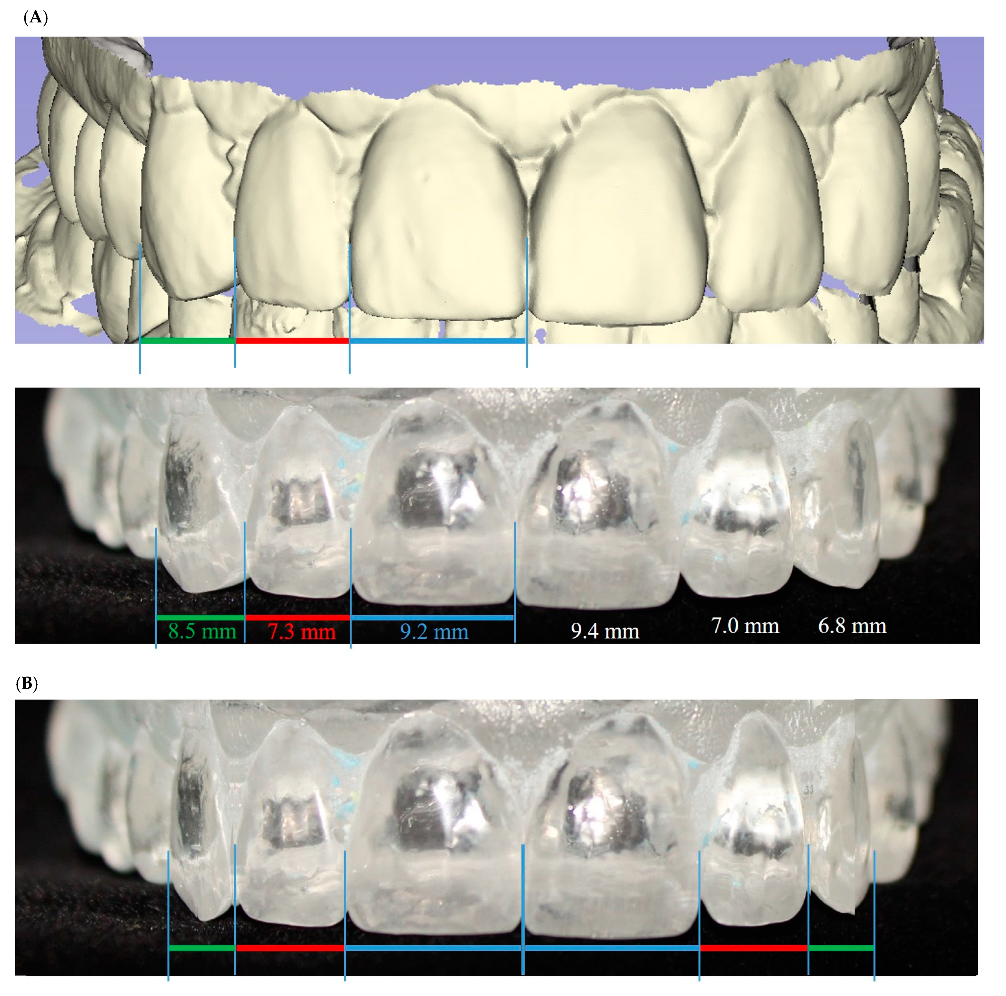 Symmetry 13 01755 g004