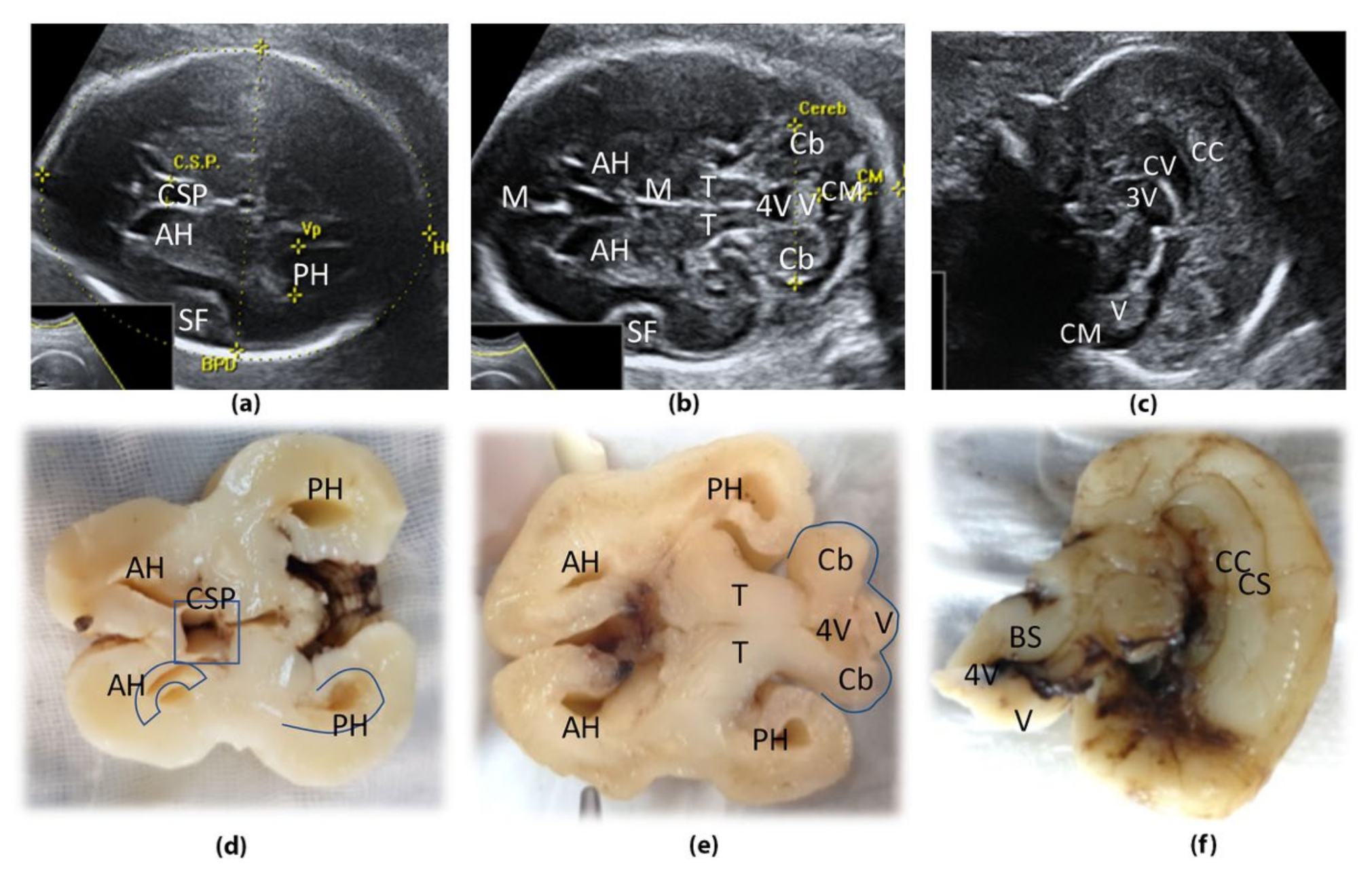 Symmetry 14 00128 g002