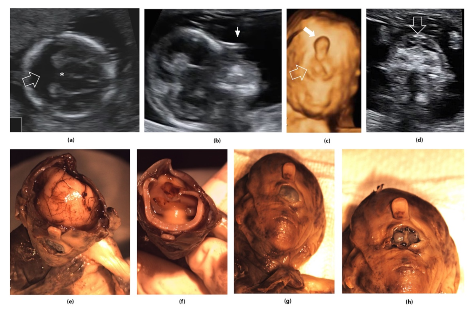 Symmetry 14 00128 g003