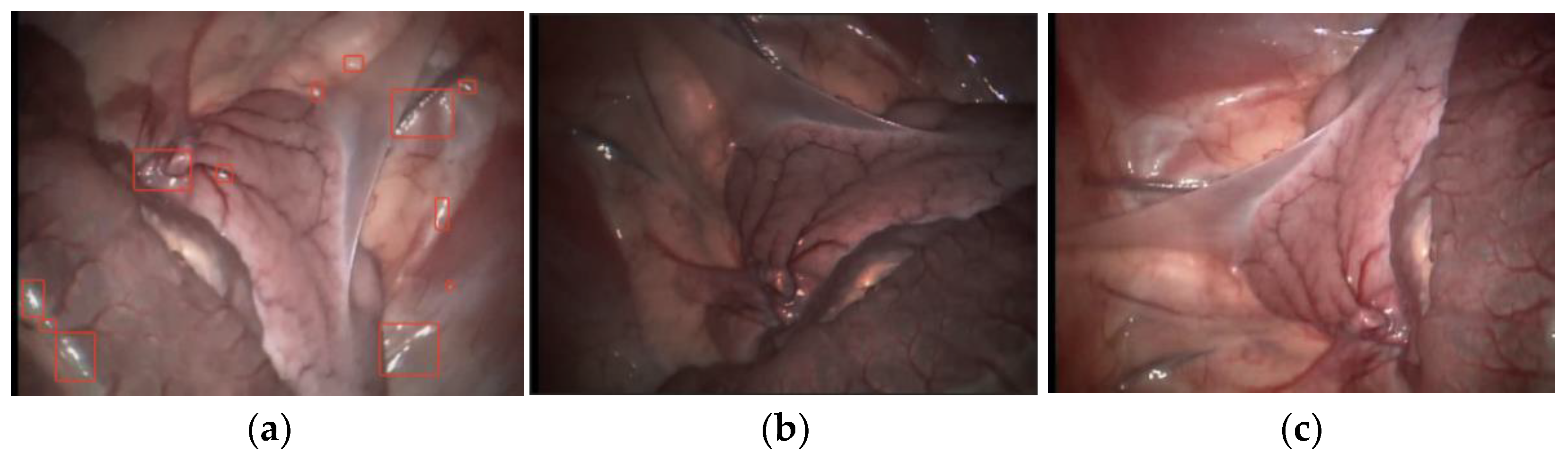 Symmetry 14 00185 g002