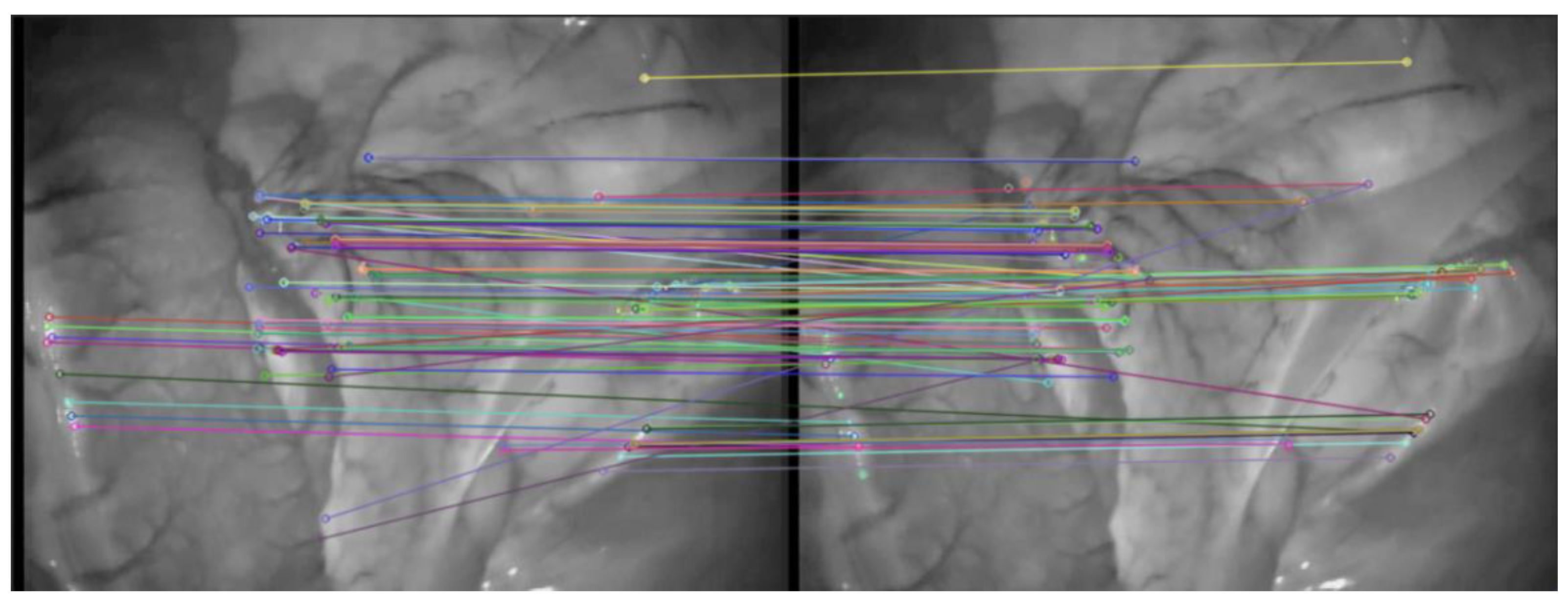 Symmetry 14 00185 g005