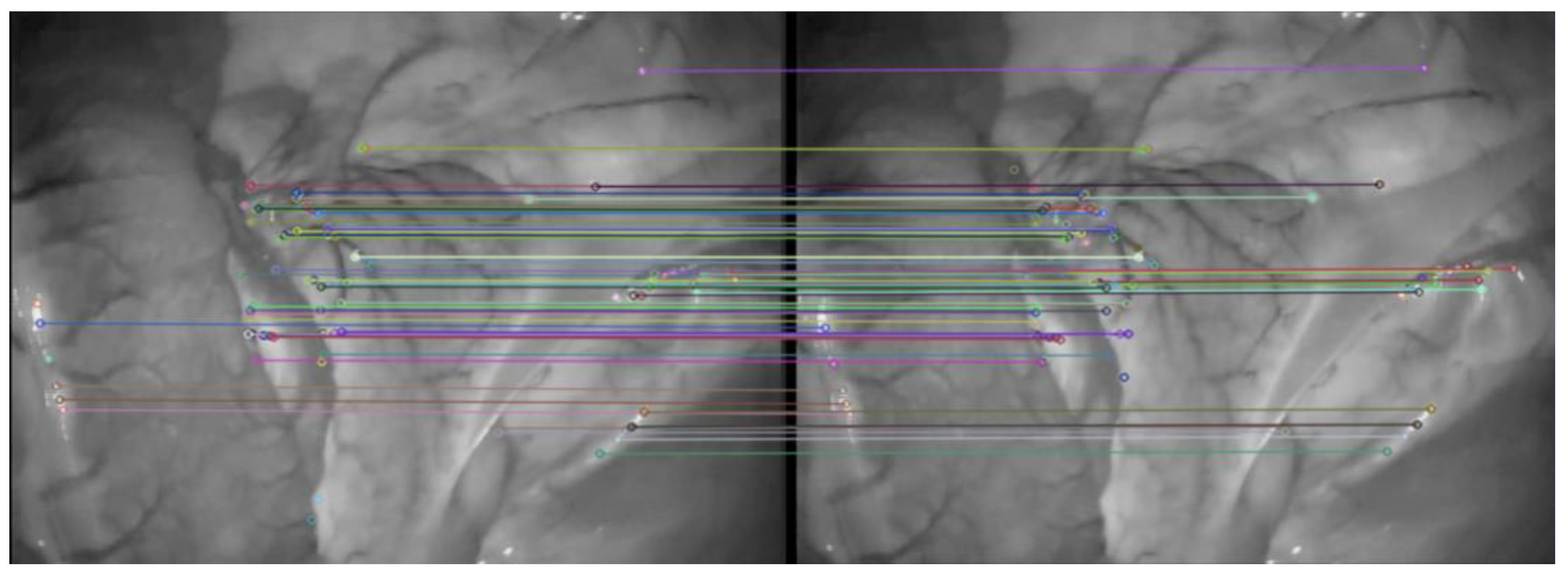 Symmetry 14 00185 g006