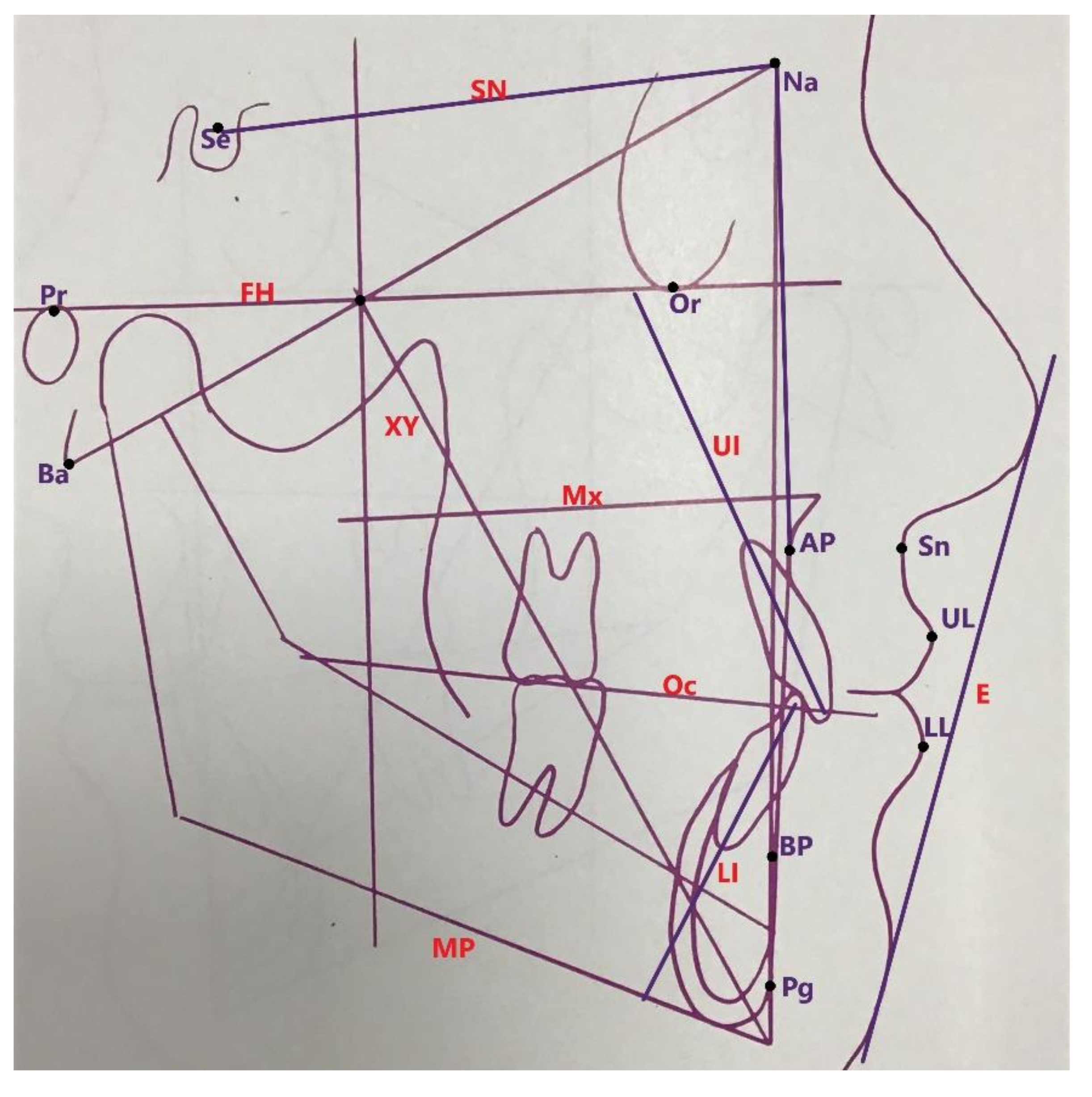 Symmetry 14 00316 g001