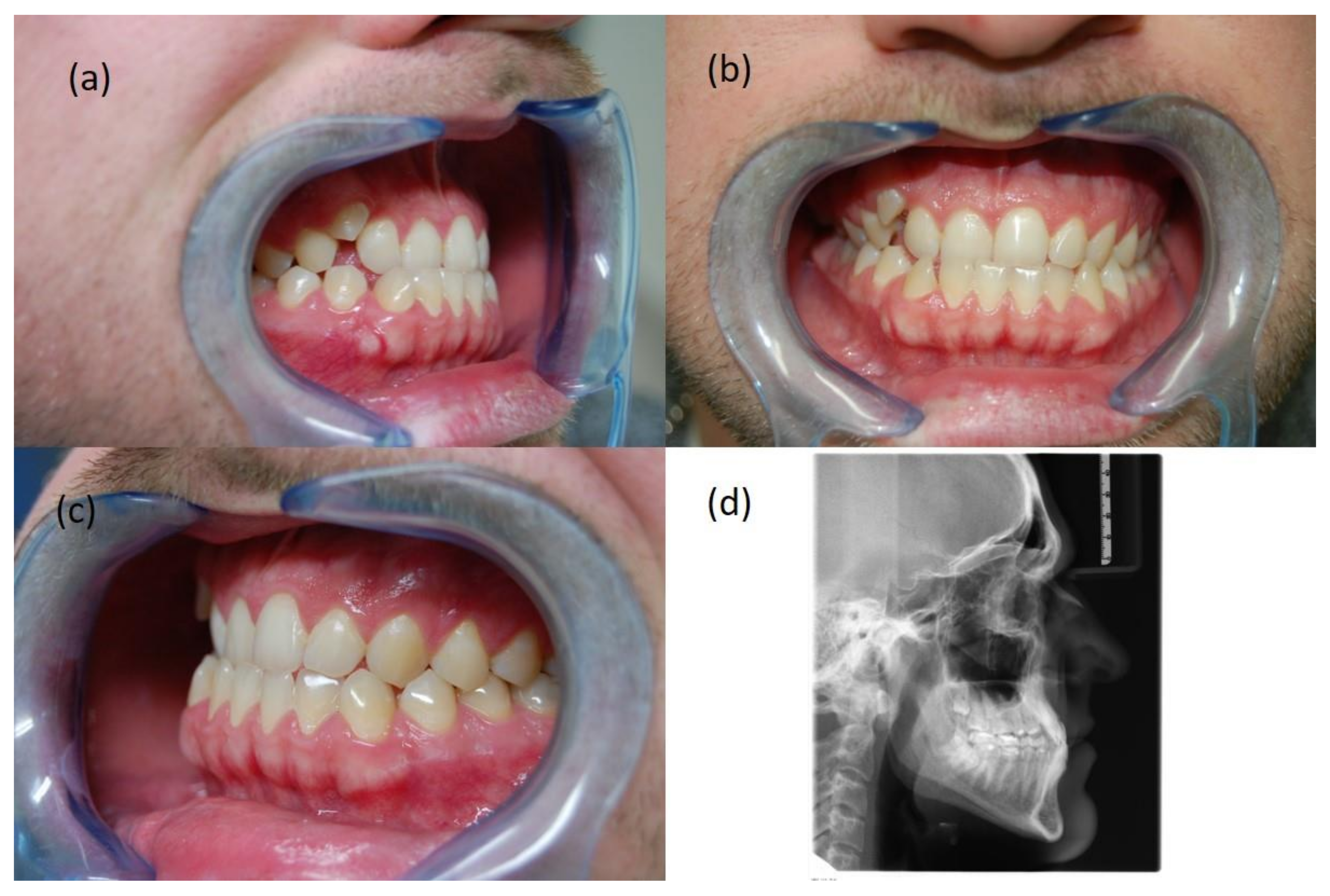 Symmetry 14 00316 g002