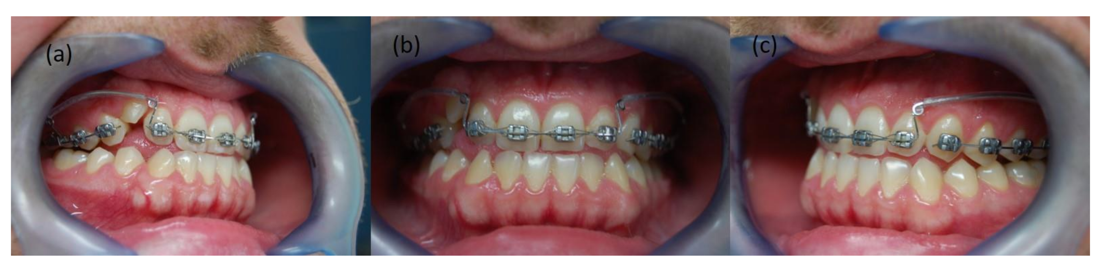 Symmetry 14 00316 g003