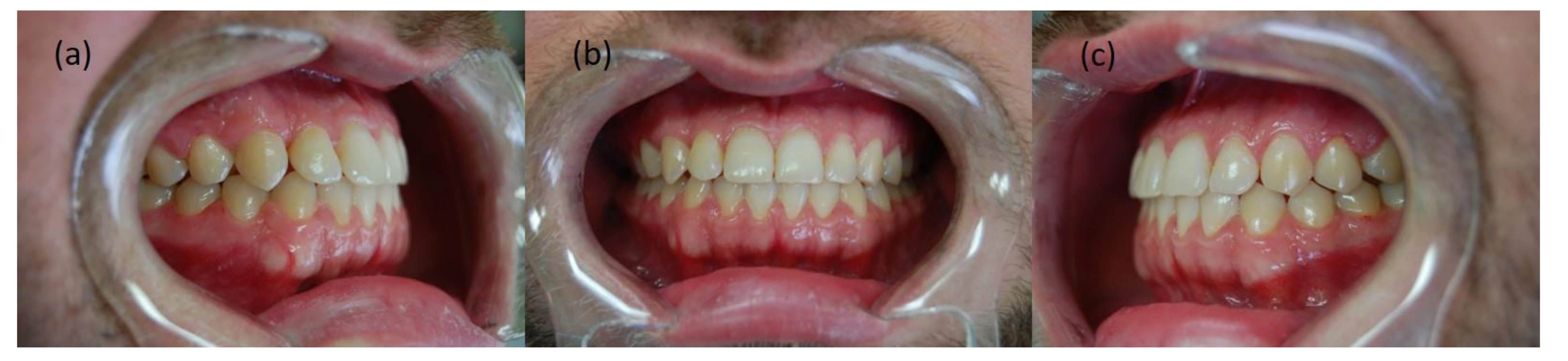 Symmetry 14 00316 g004