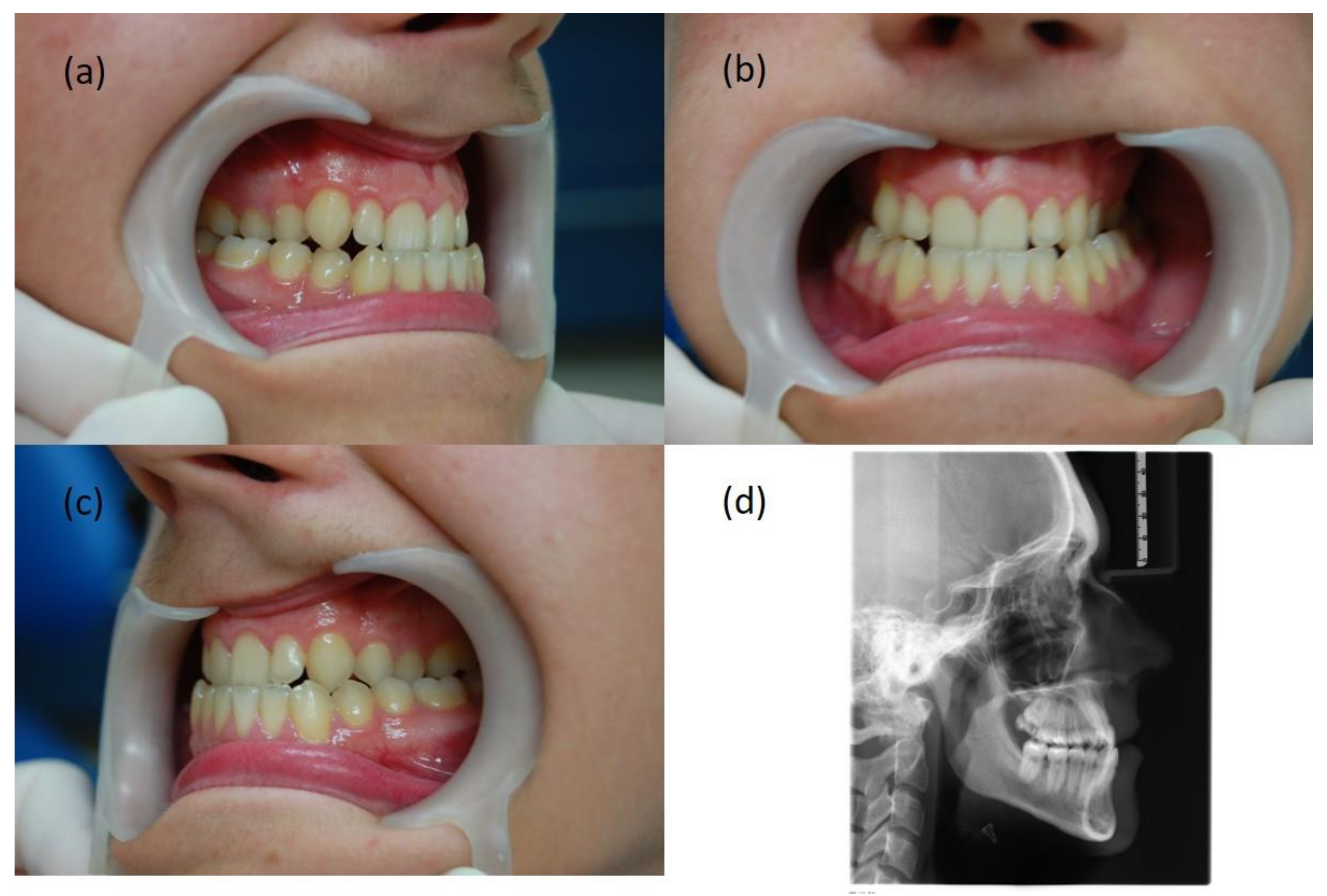 Symmetry 14 00316 g005
