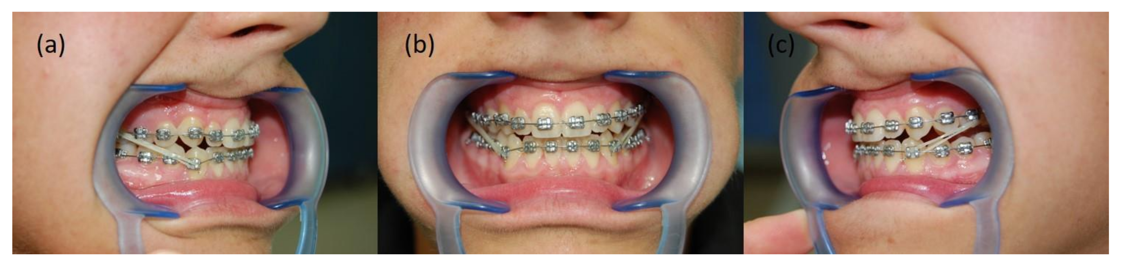 Symmetry 14 00316 g006