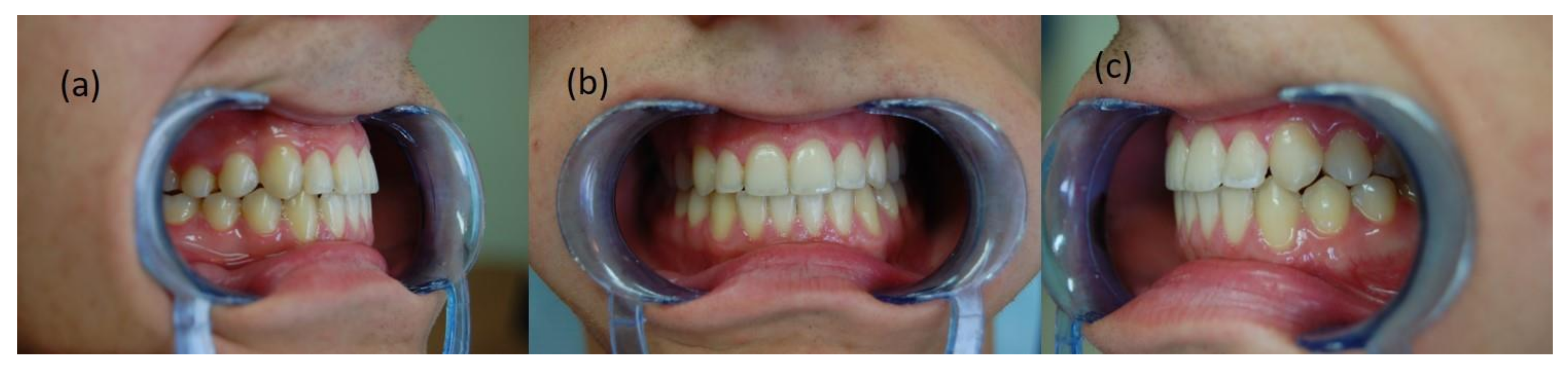 Symmetry 14 00316 g007