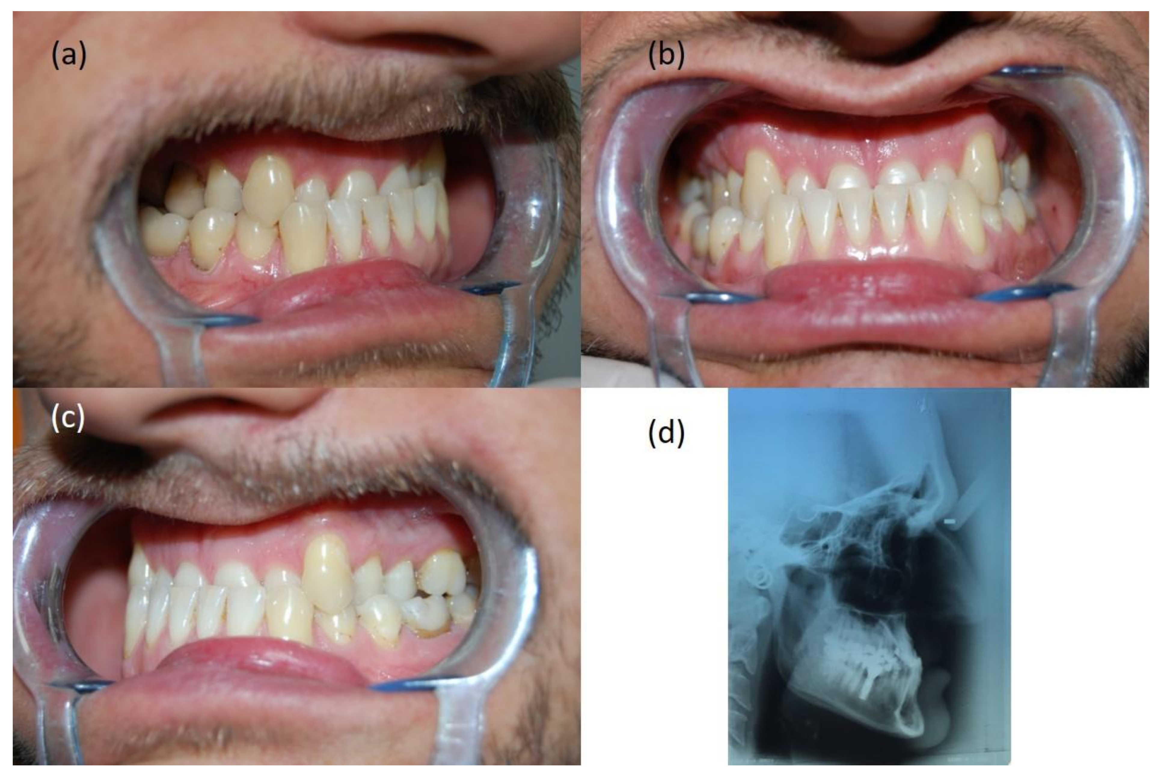 Symmetry 14 00316 g008