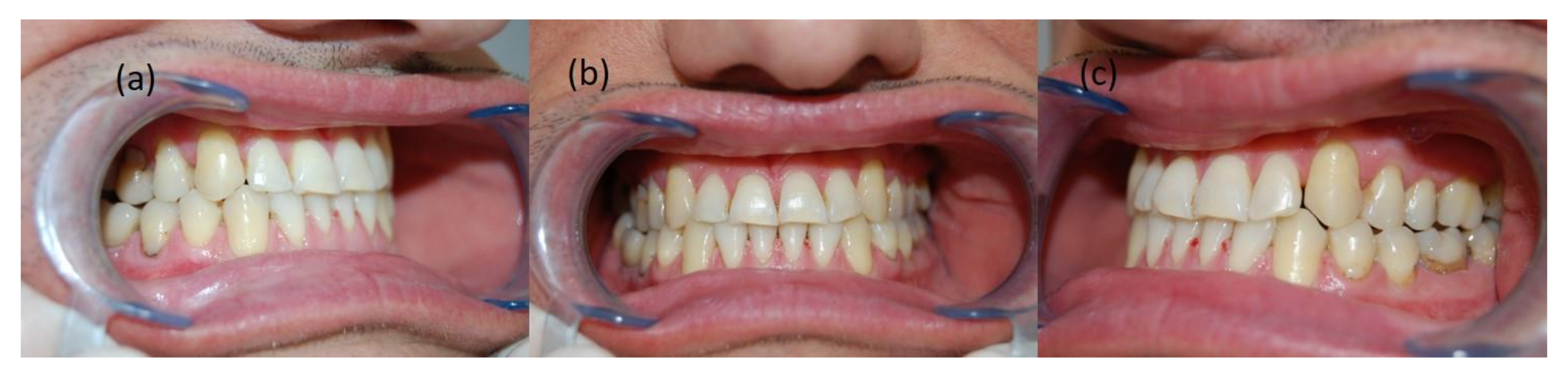 Symmetry 14 00316 g009