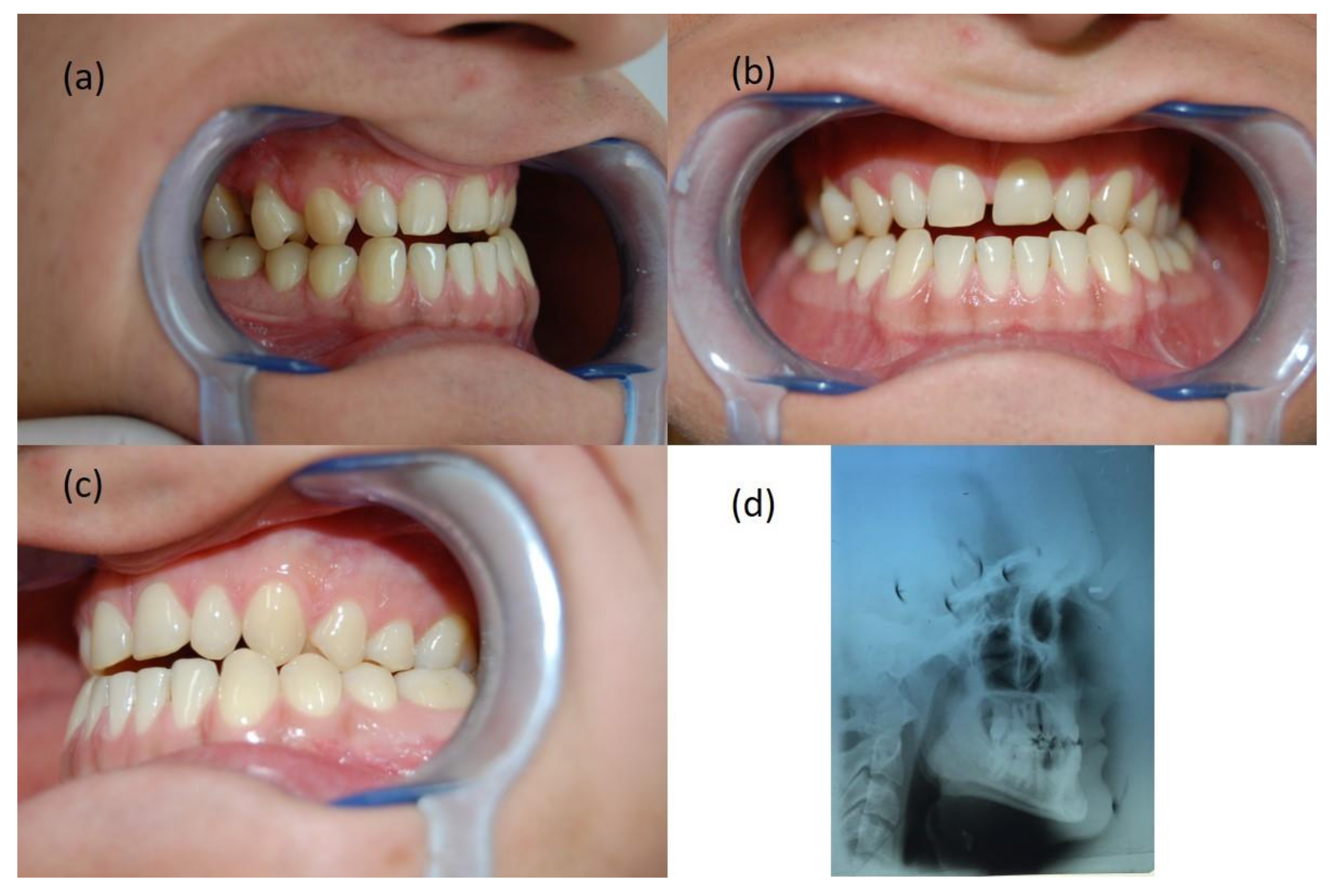 Symmetry 14 00316 g010