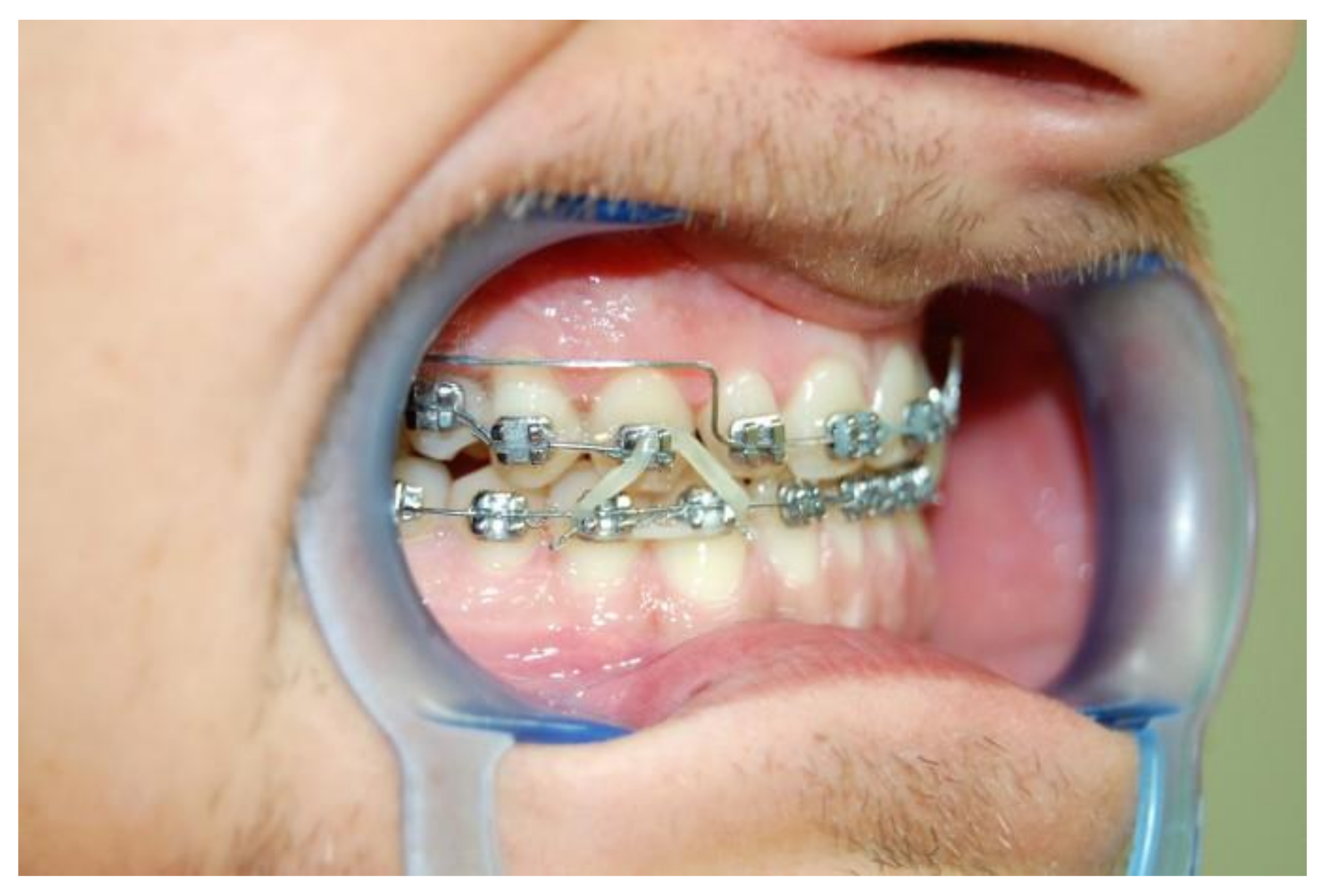 Symmetry 14 00316 g013