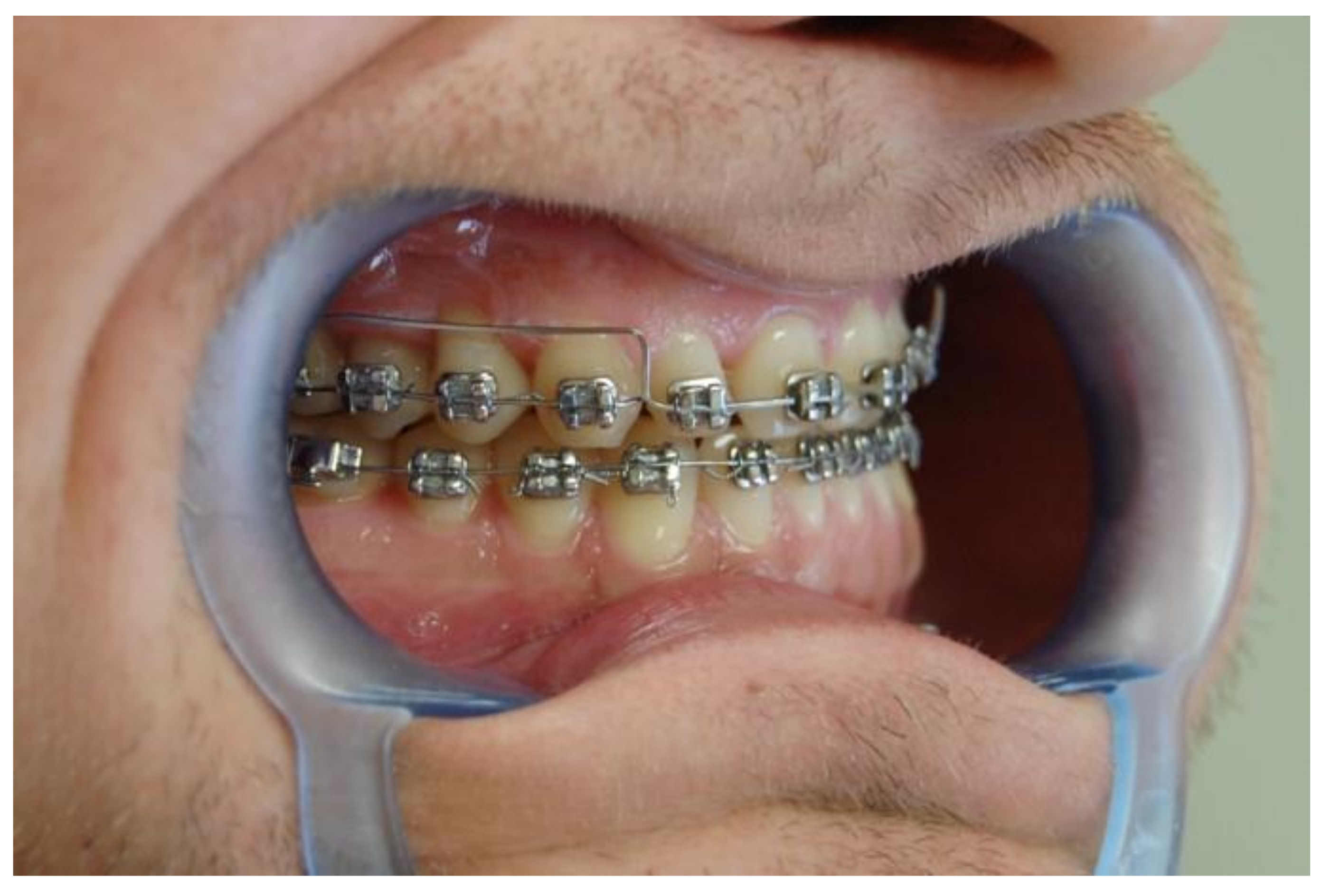 Symmetry 14 00316 g014