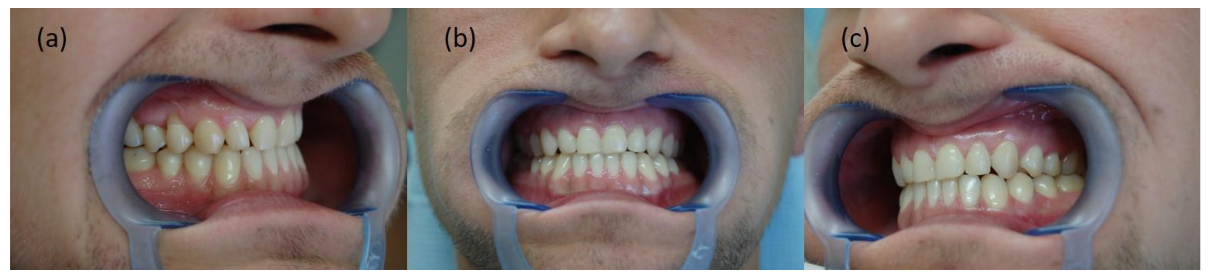 Symmetry 14 00316 g015