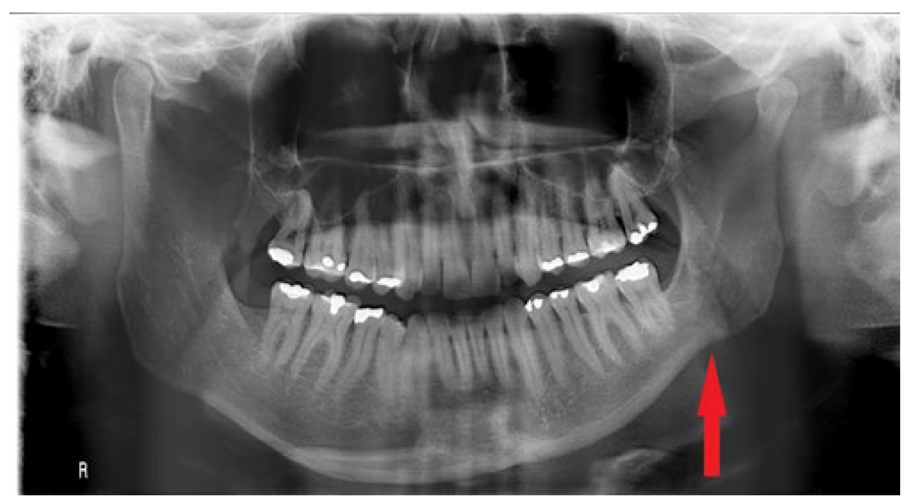 Symmetry 14 01287 g001