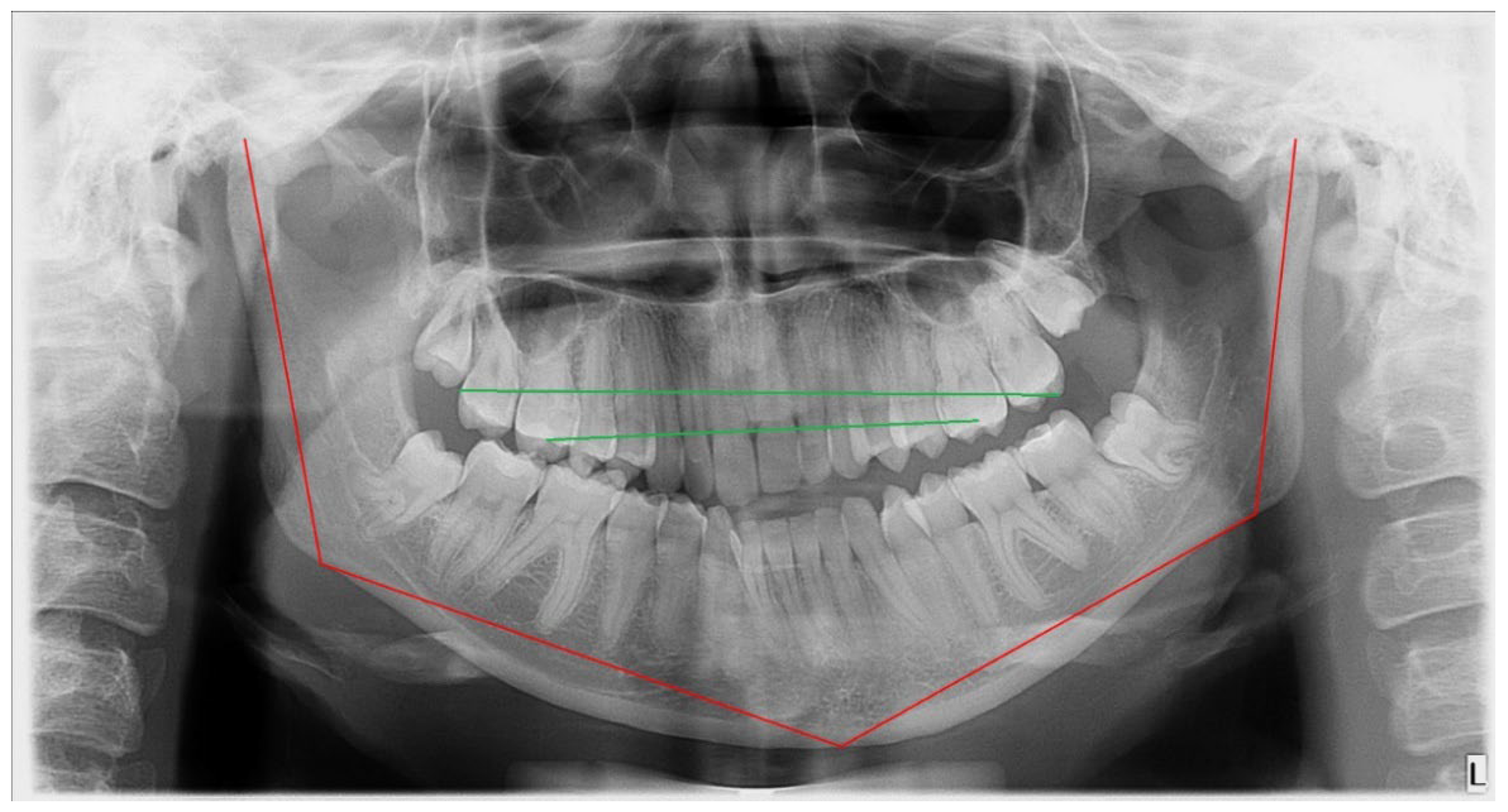 Symmetry 14 01287 g003