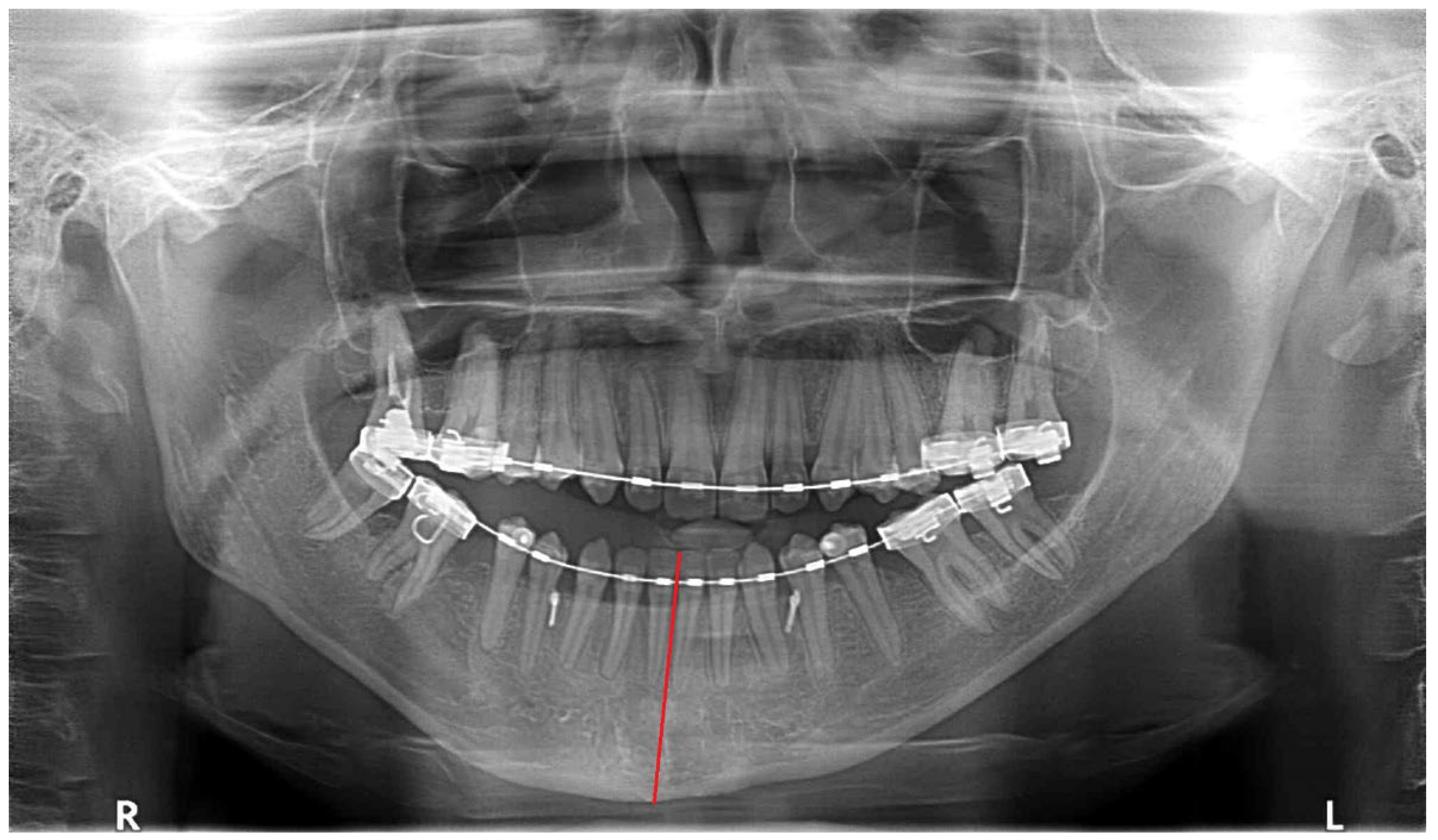 Symmetry 14 01287 g004
