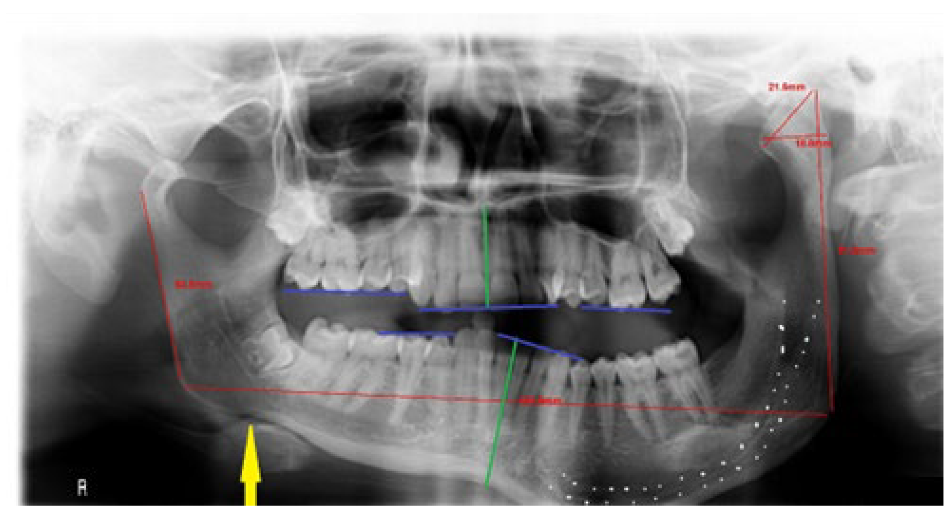 Symmetry 14 01287 g005