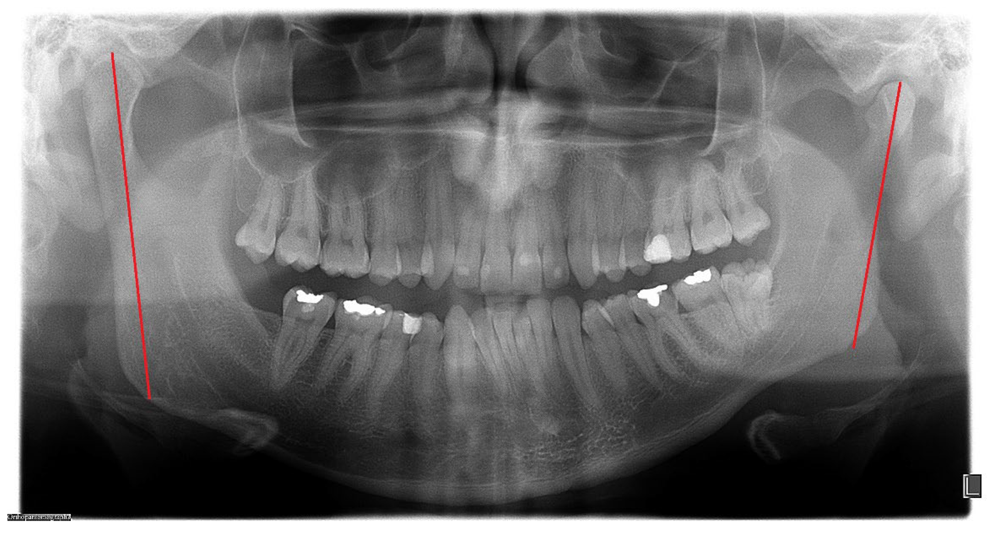 Symmetry 14 01287 g006