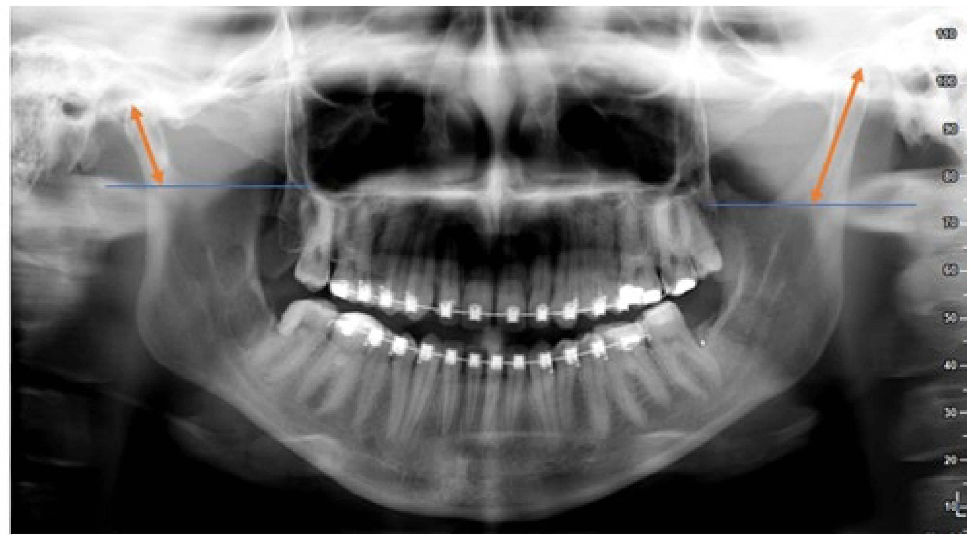 Symmetry 14 01287 g007