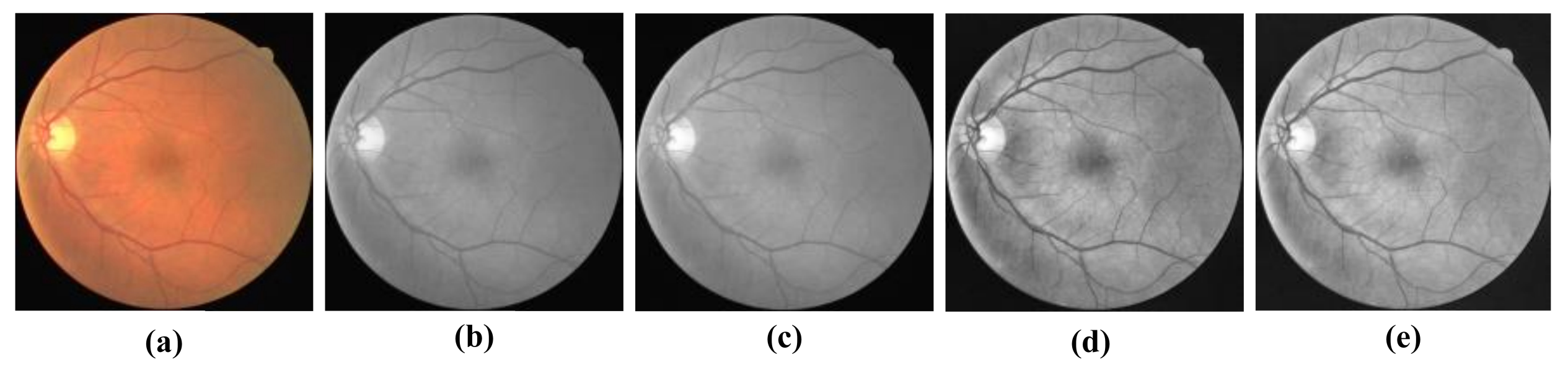 Symmetry 14 01357 g005