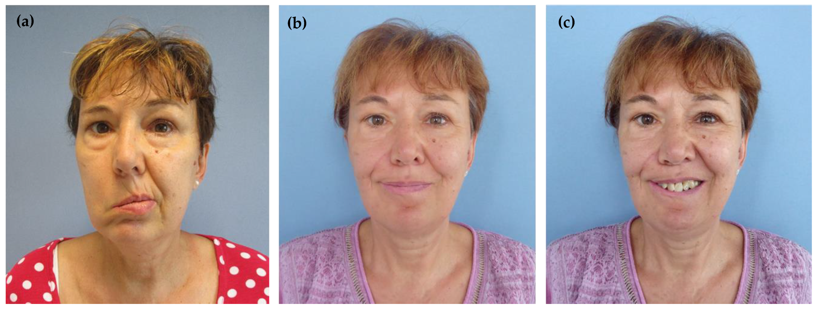 Symmetry 15 00561 g003