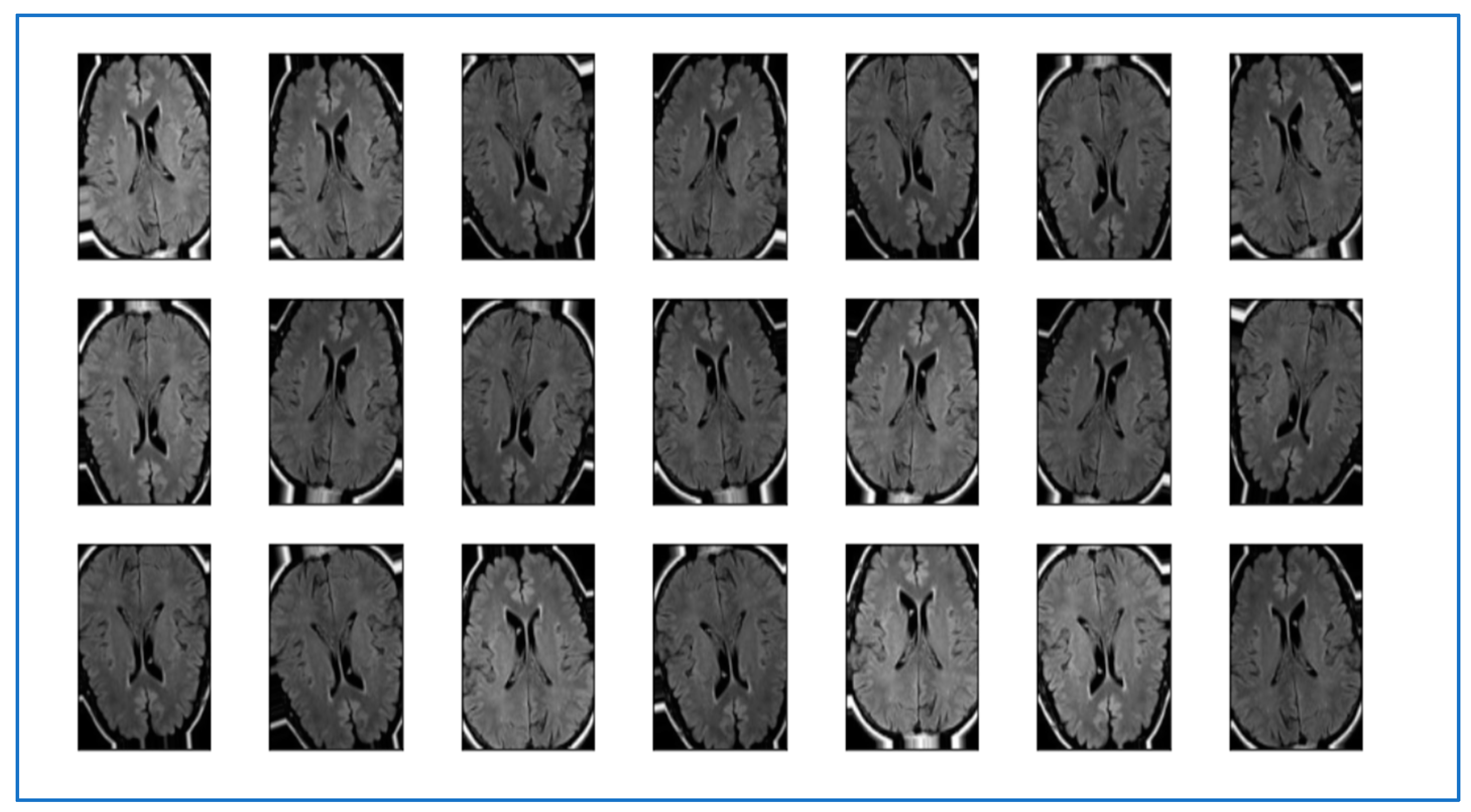 Symmetry 15 00571 g005