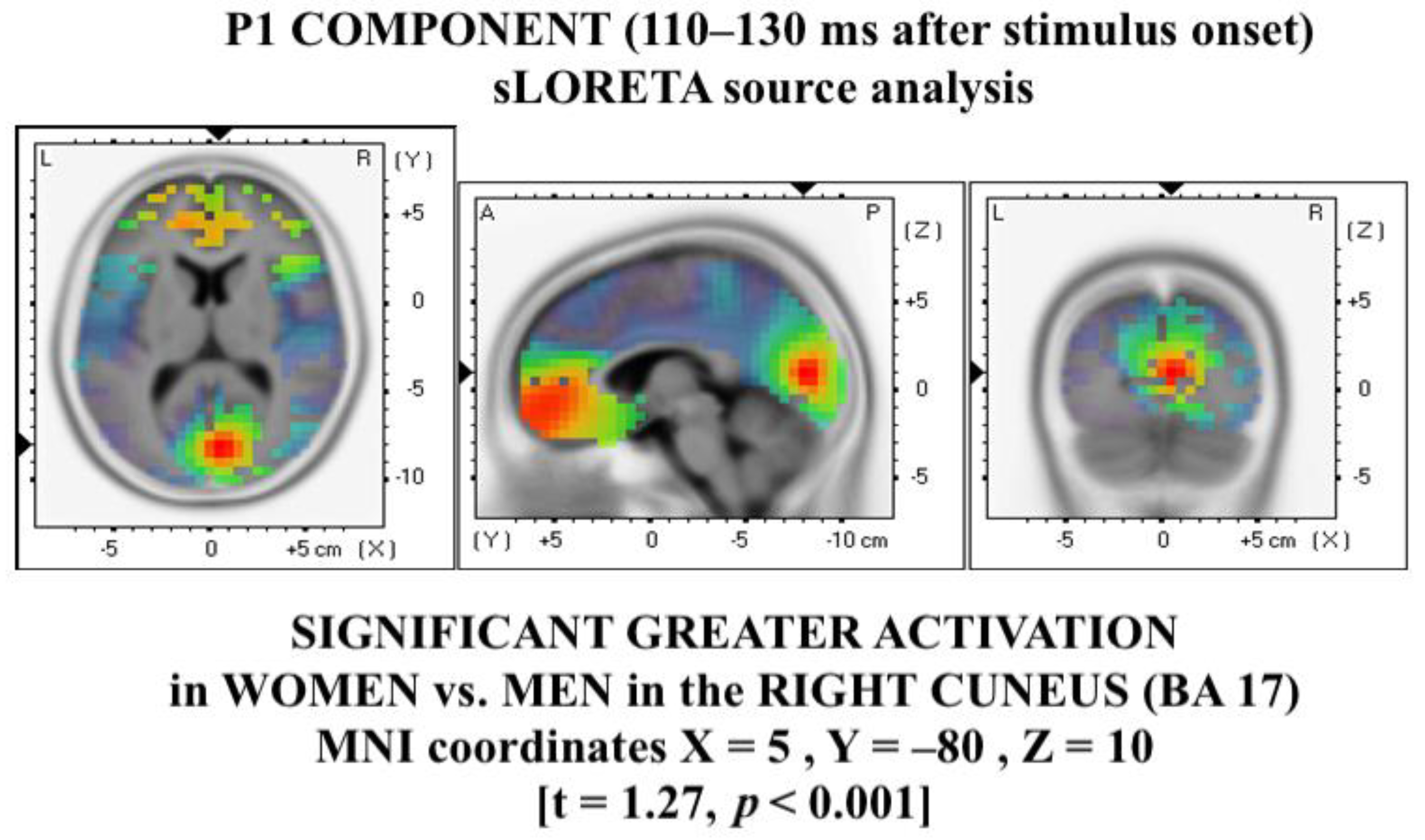 Symmetry 15 00610 g004