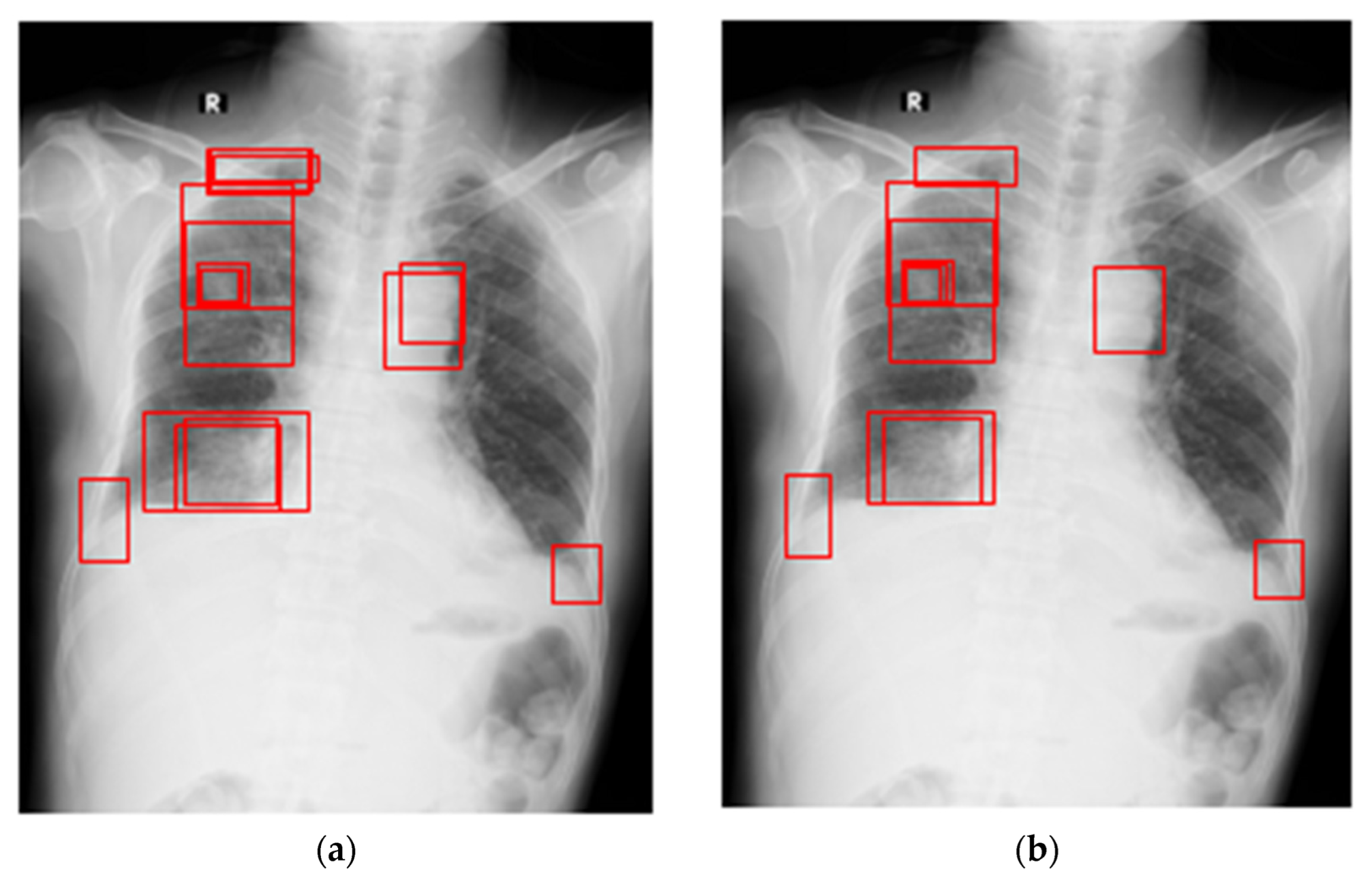 Symmetry 15 00668 g005