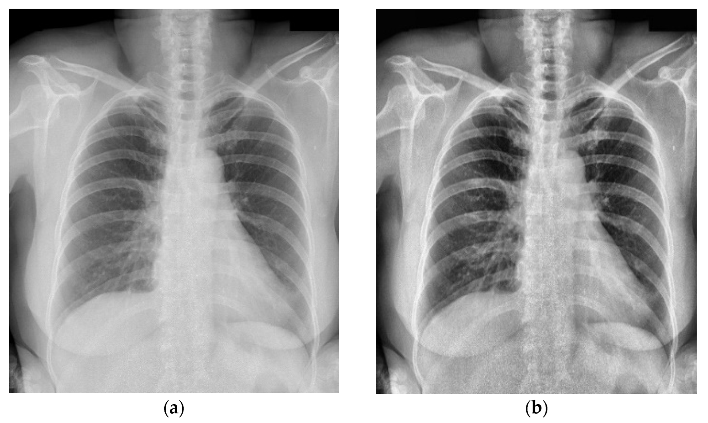 Symmetry 15 00668 g006