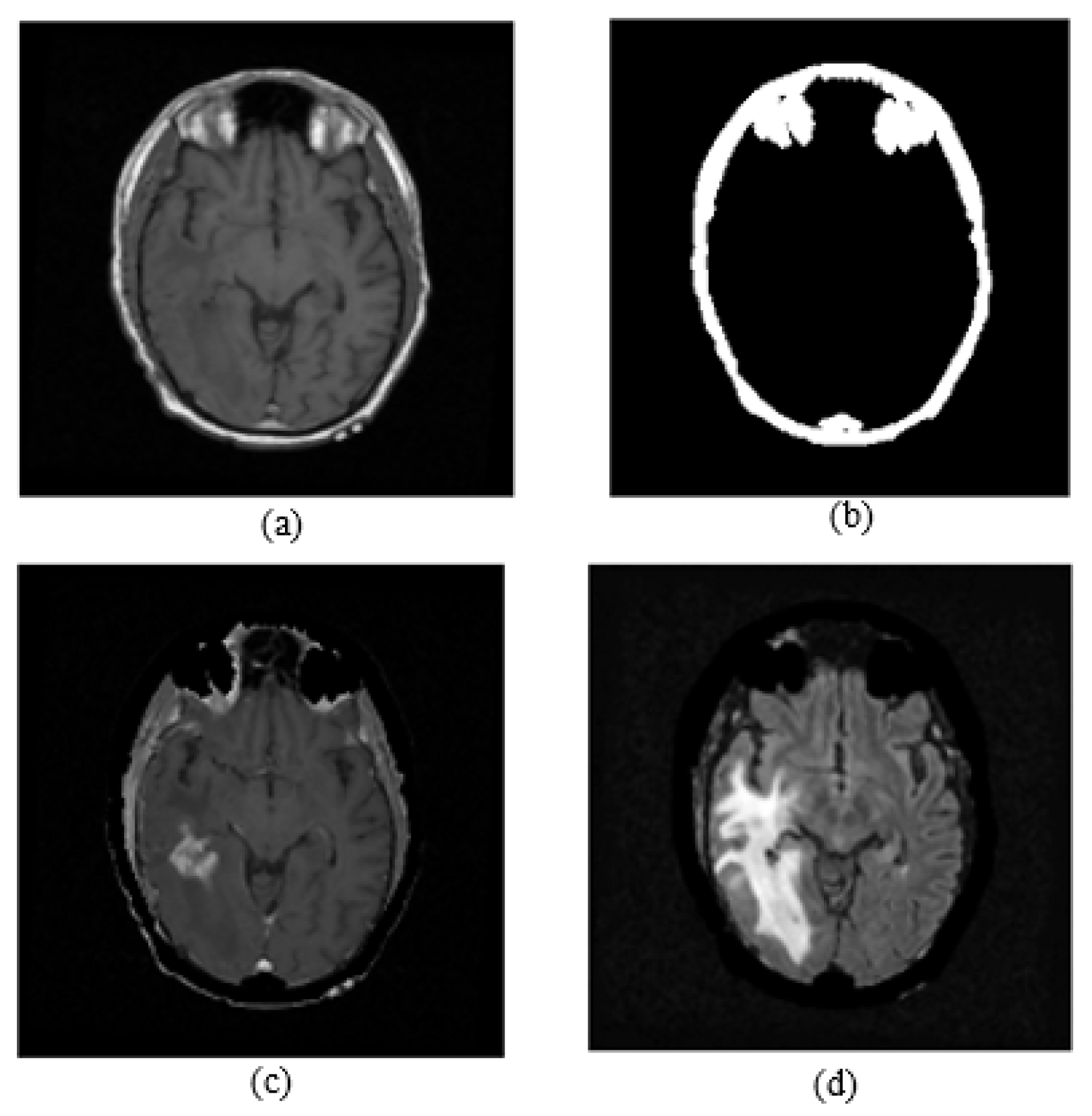 Symmetry 15 01586 g005