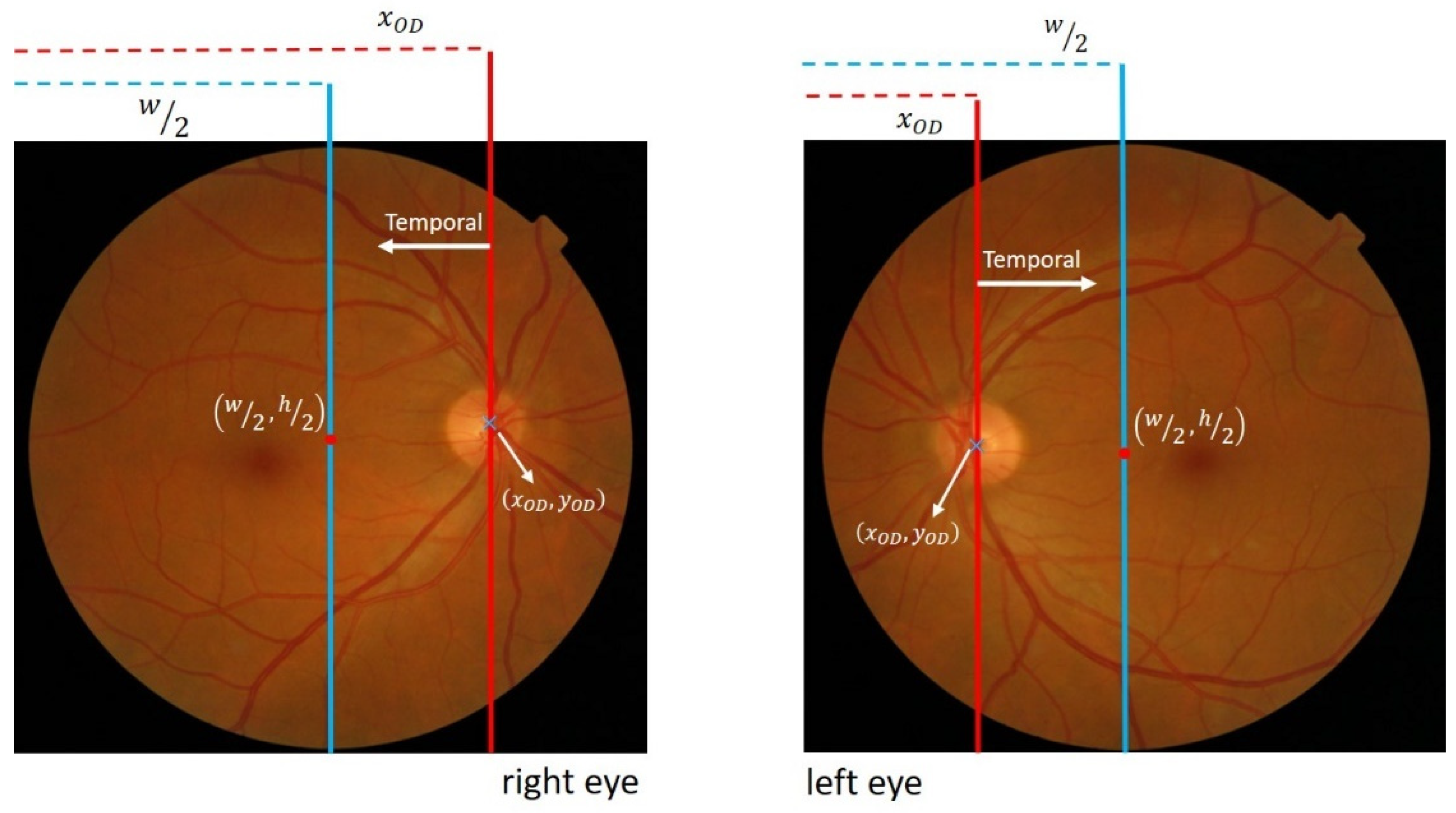 Symmetry 15 01631 g007