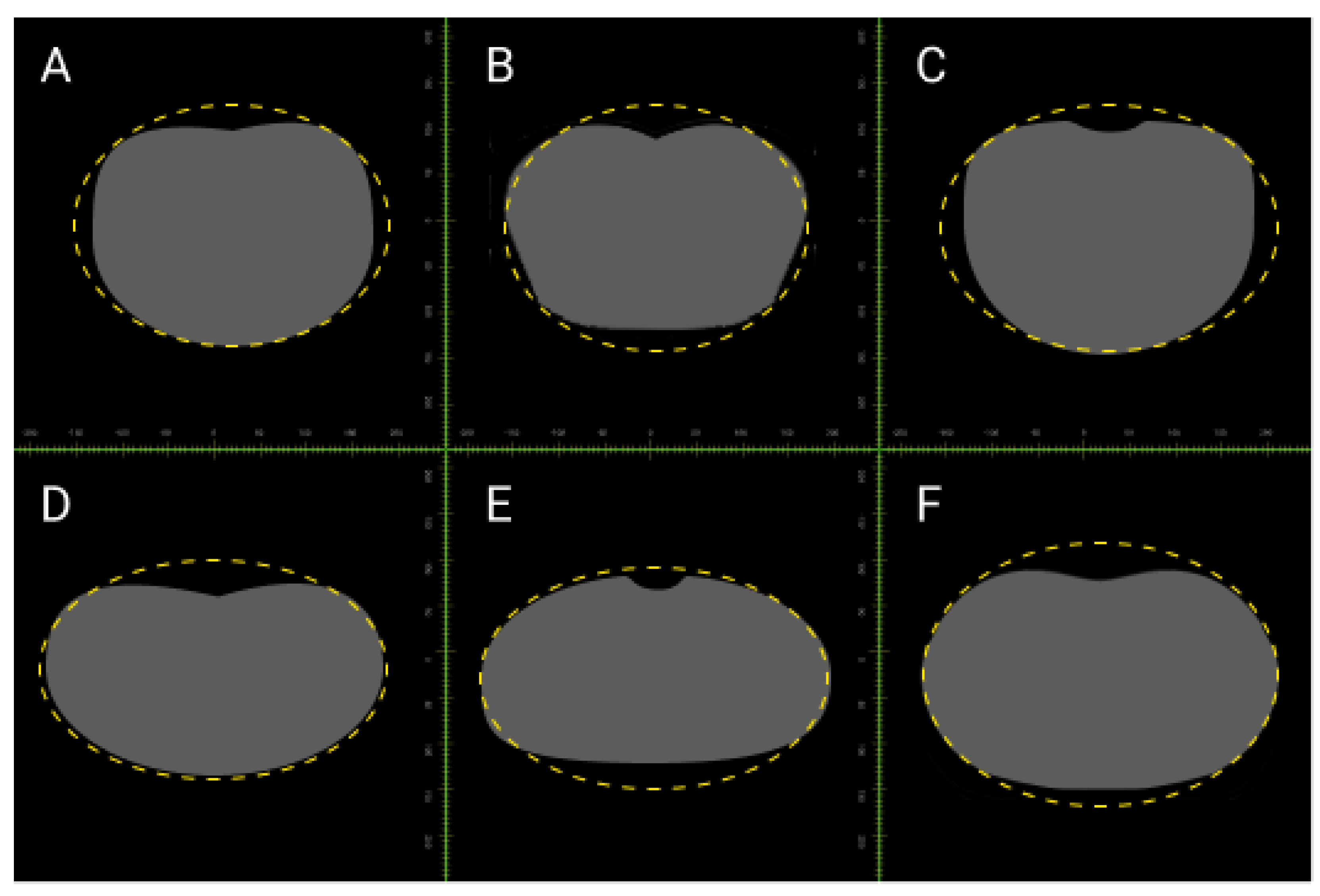 Symmetry 16 00049 g008