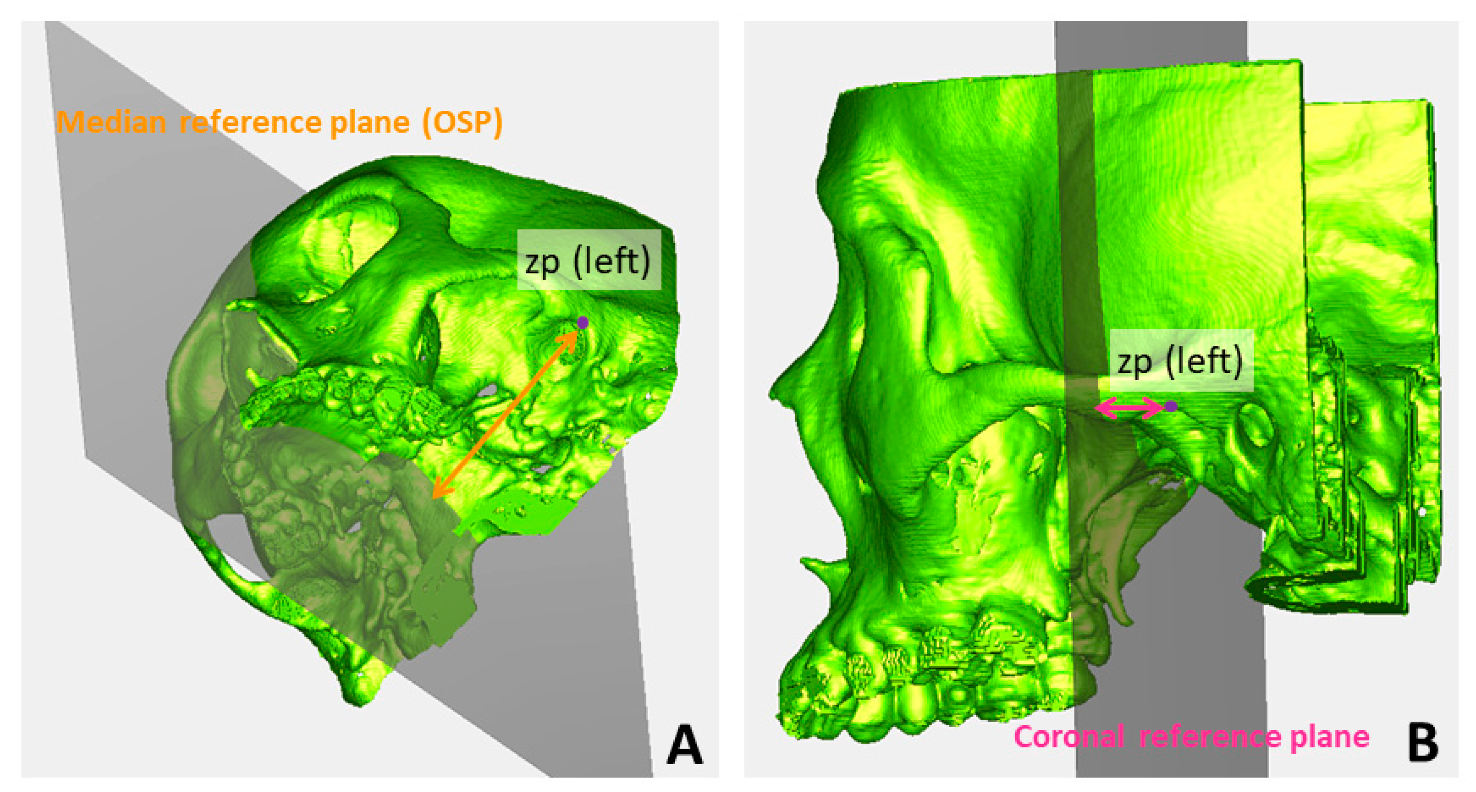 Symmetry 16 00490 g003