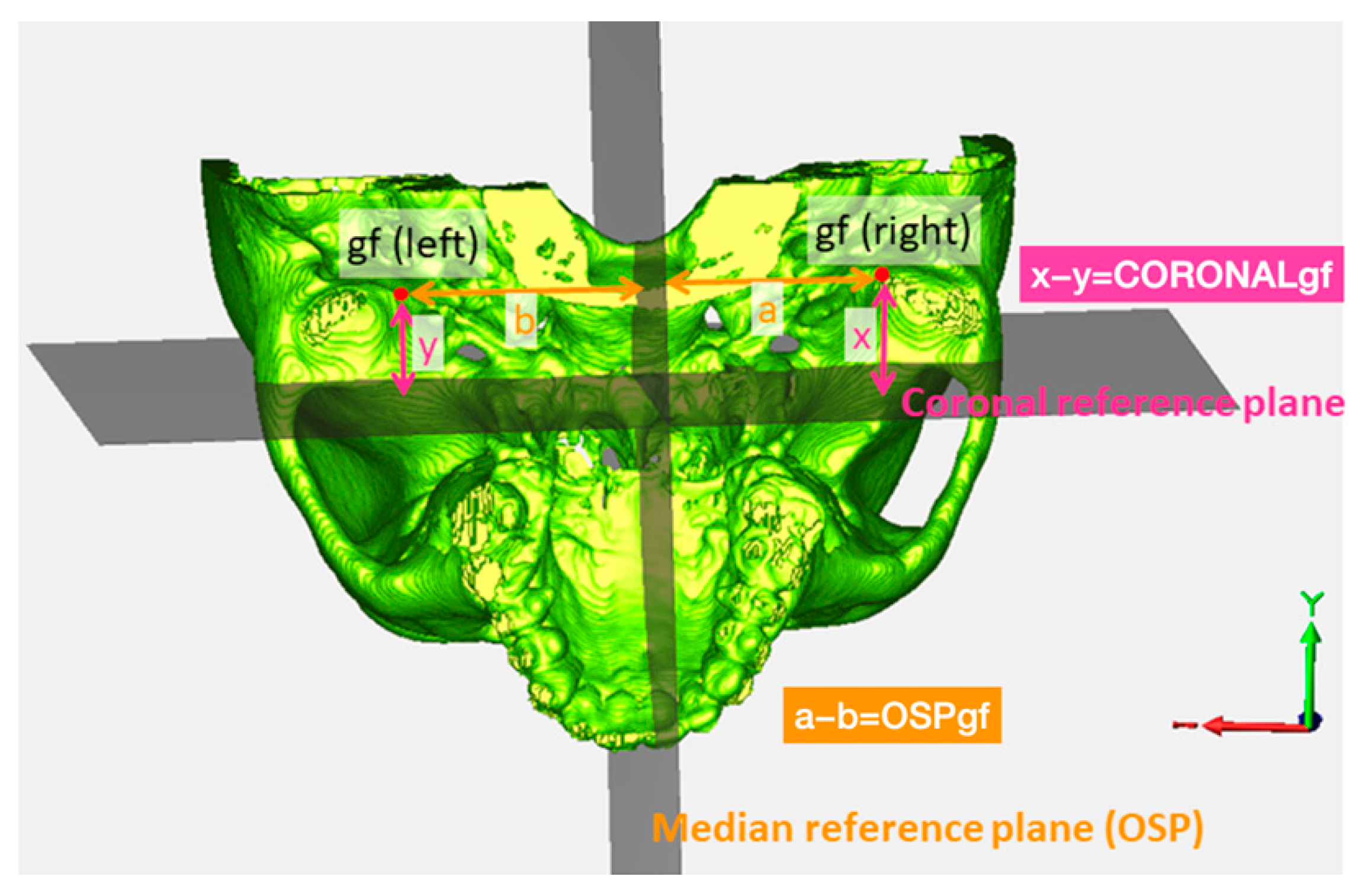 Symmetry 16 00490 g004