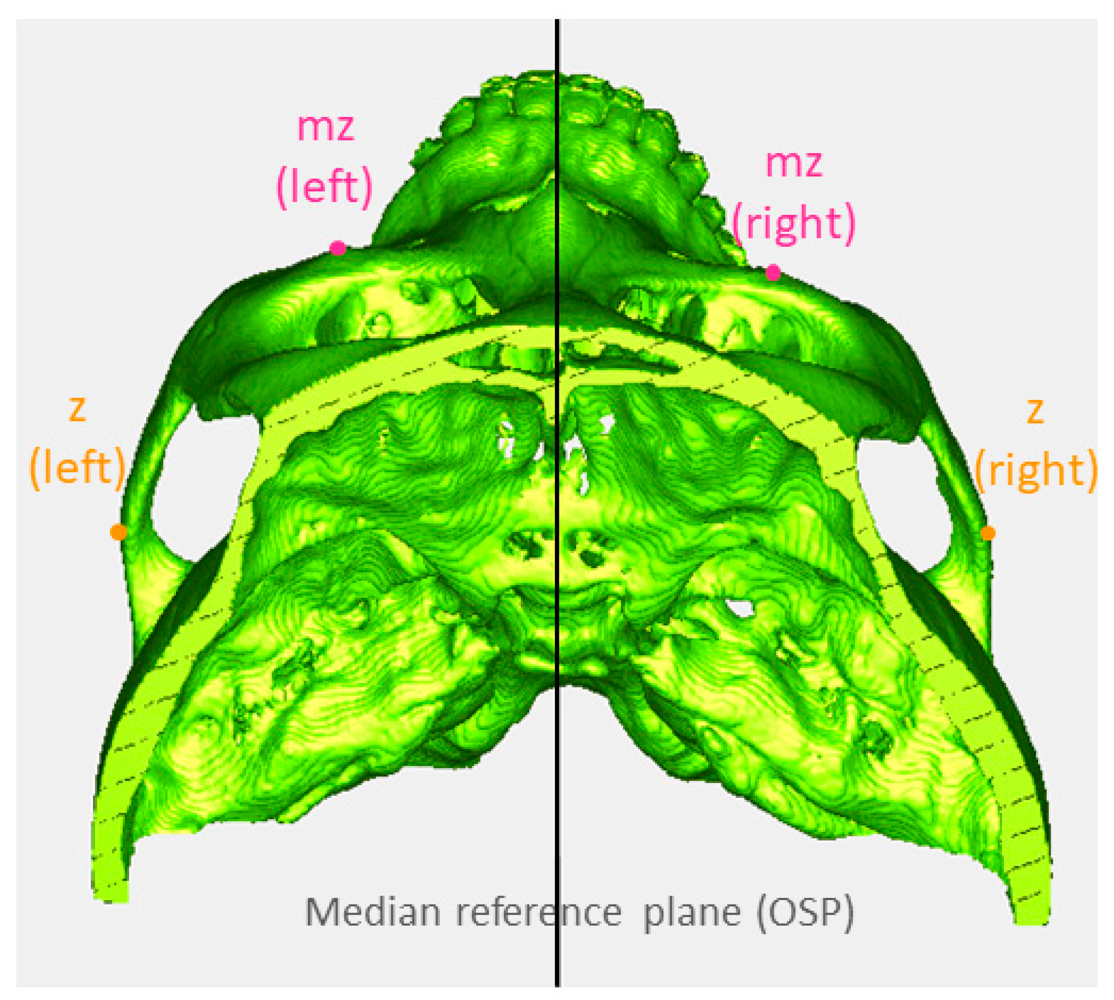 Symmetry 16 00490 g005