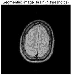 Symmetry 17 02120 i001