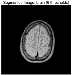Symmetry 17 02120 i002
