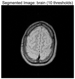 Symmetry 17 02120 i004