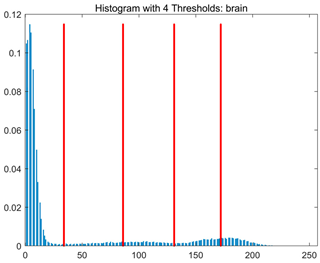 Symmetry 17 02120 i005