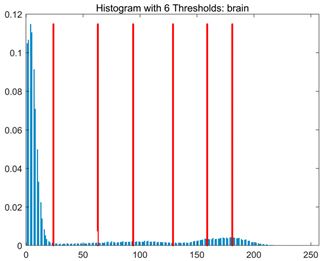 Symmetry 17 02120 i006